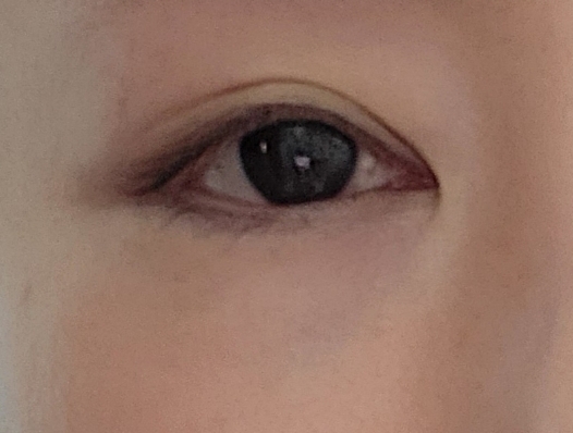후