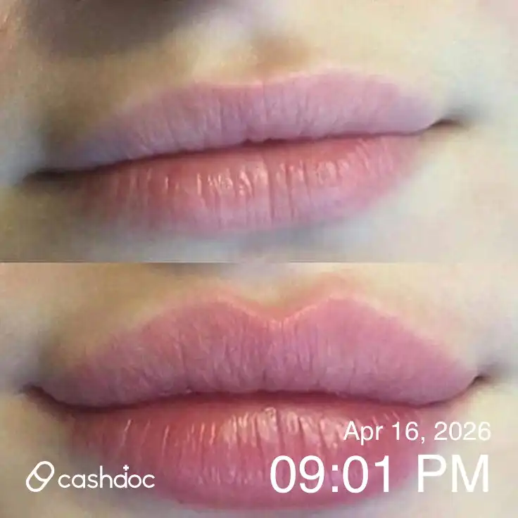 Review photo