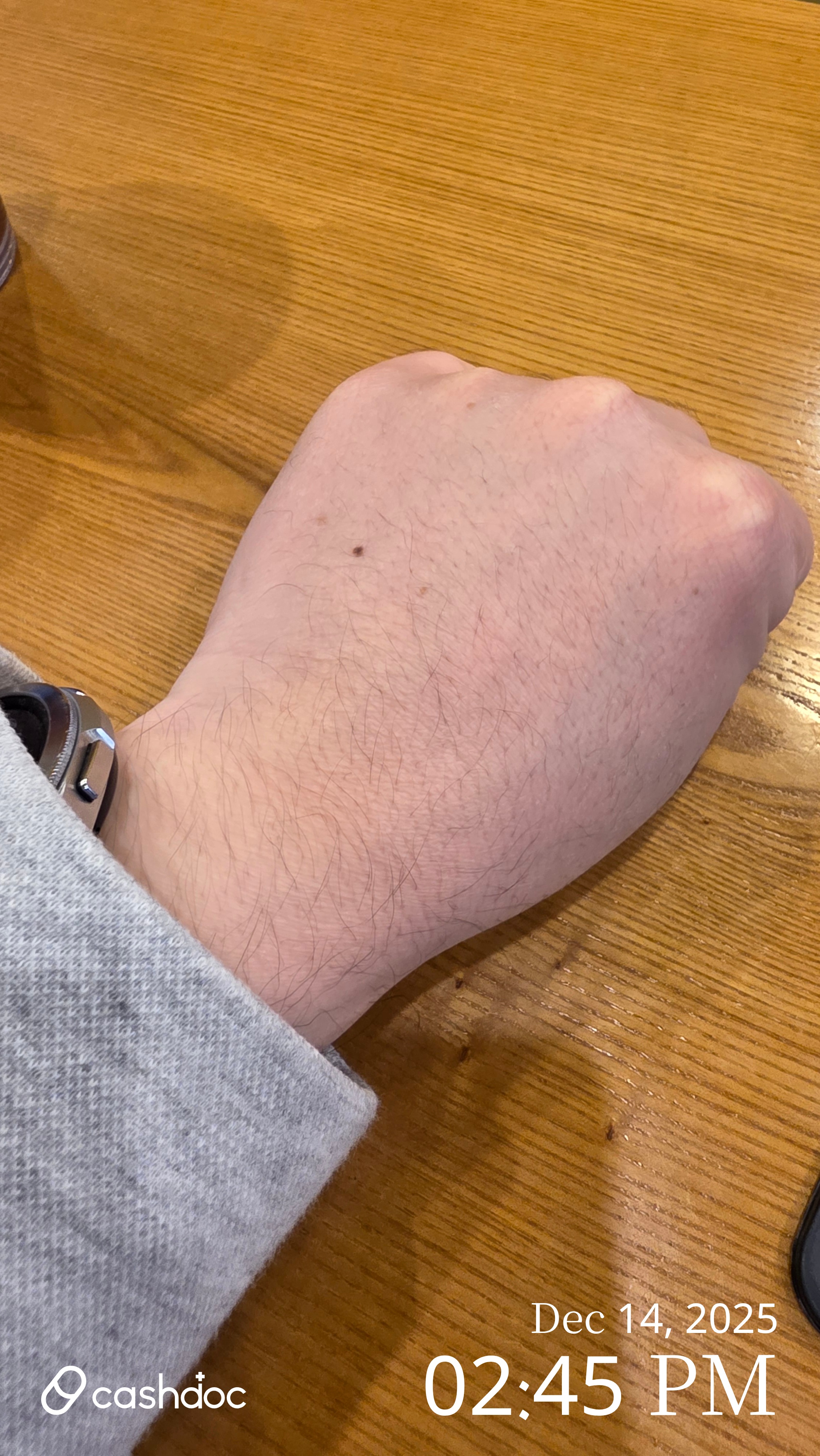 수원시 서울미피부과의원에서 피부 회복 경험 칭찬해요!