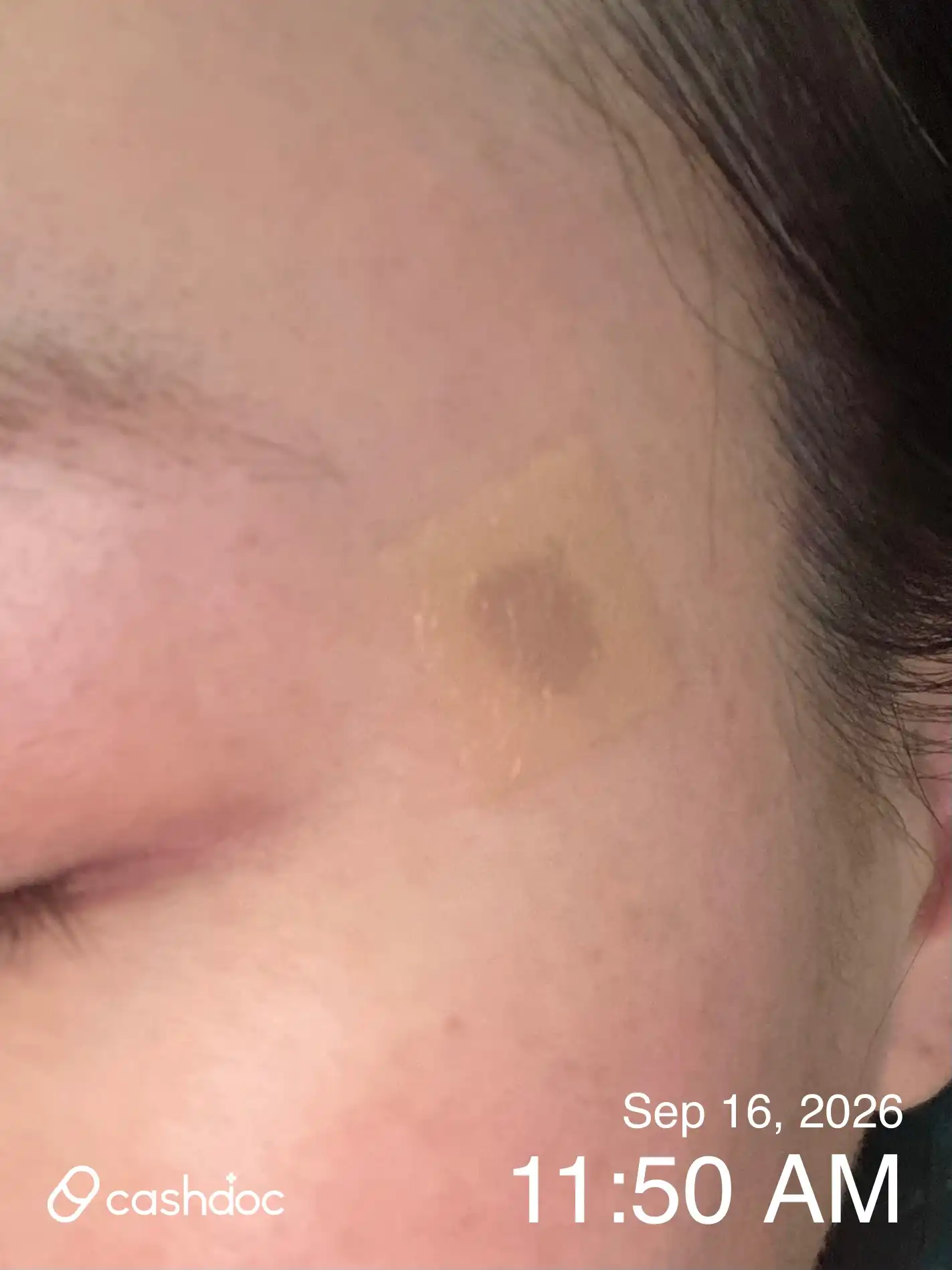Review photo
