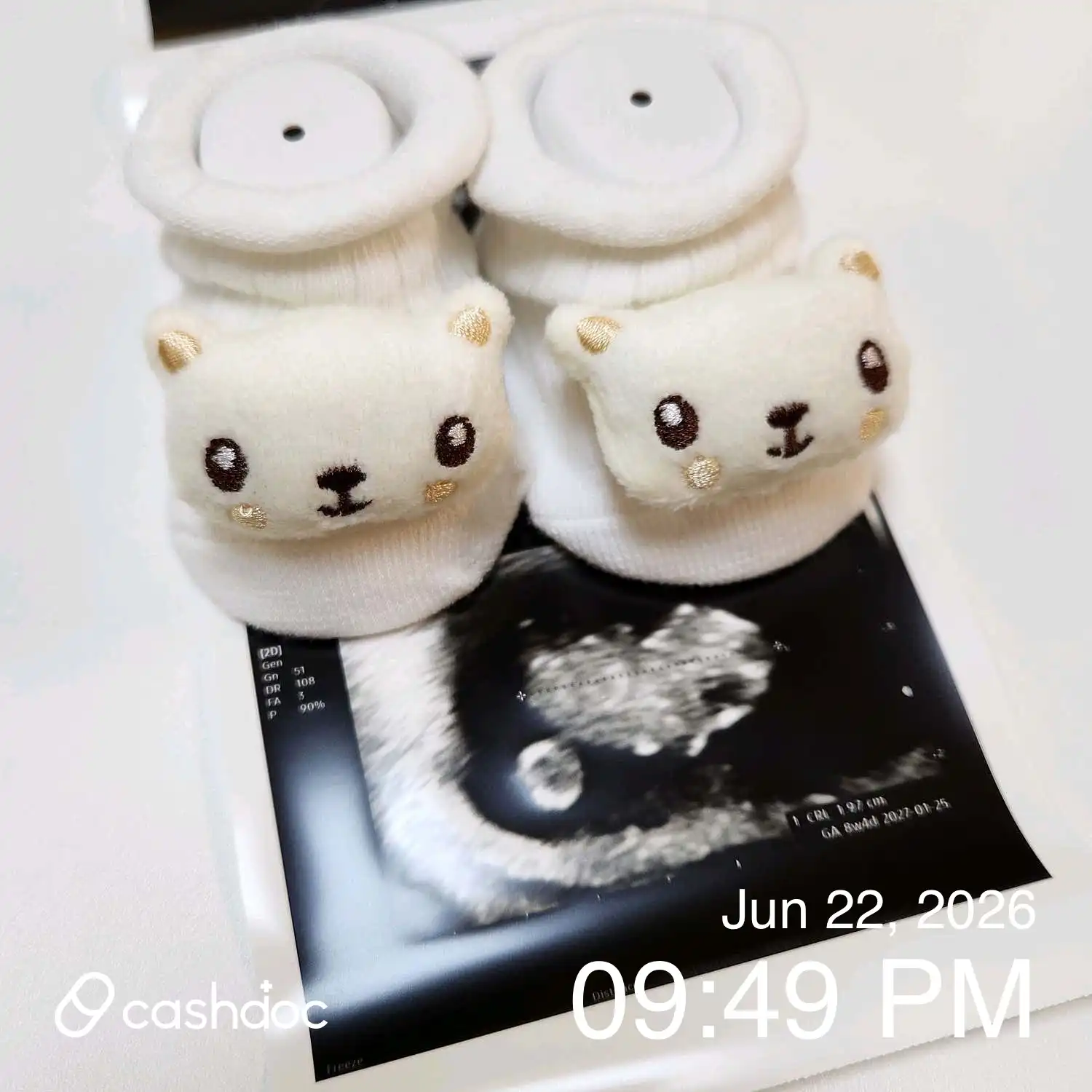 Review photo