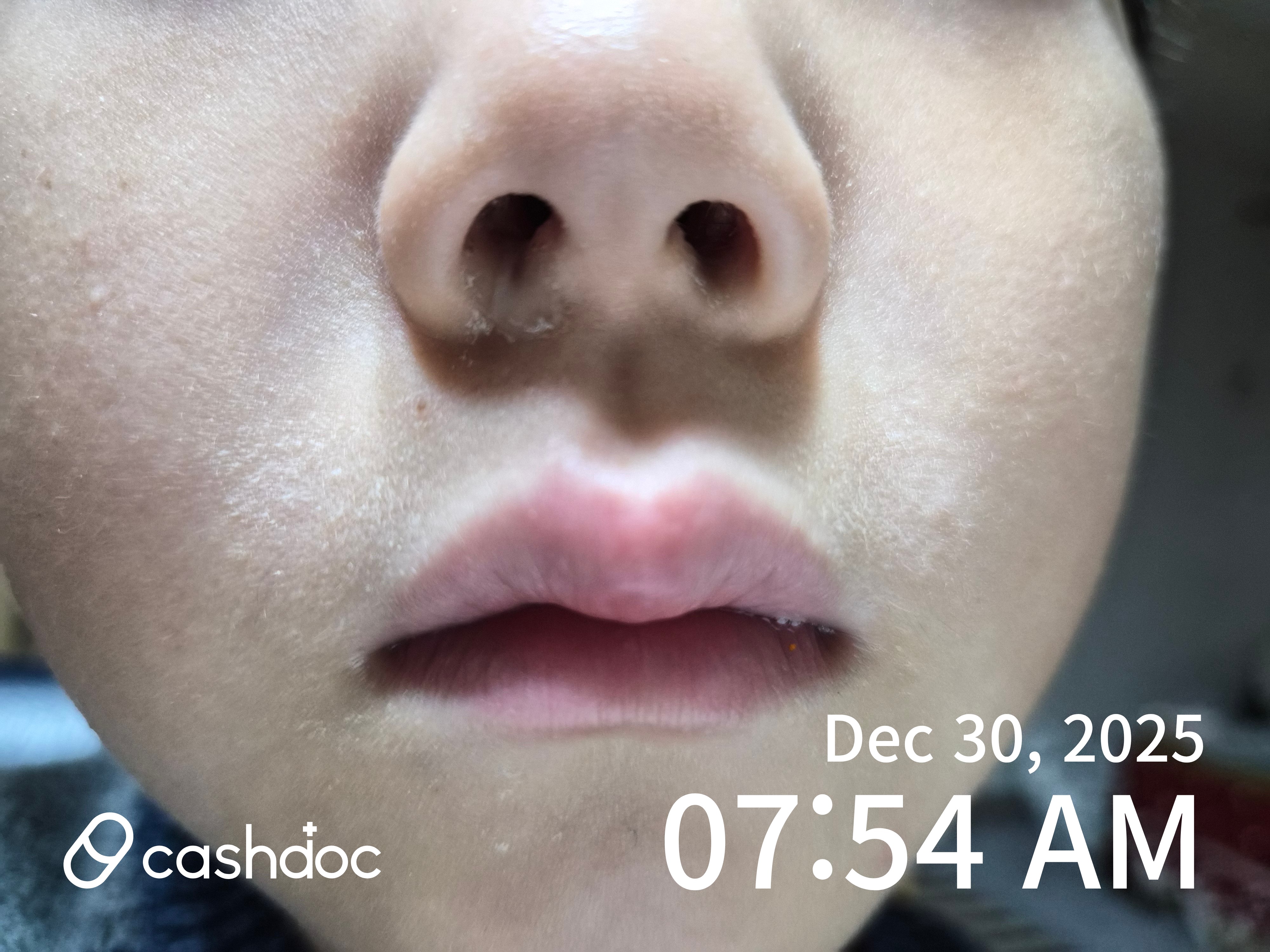 평택시 이승균이비인후과의원, 효과 없는 감기약 처방 경험