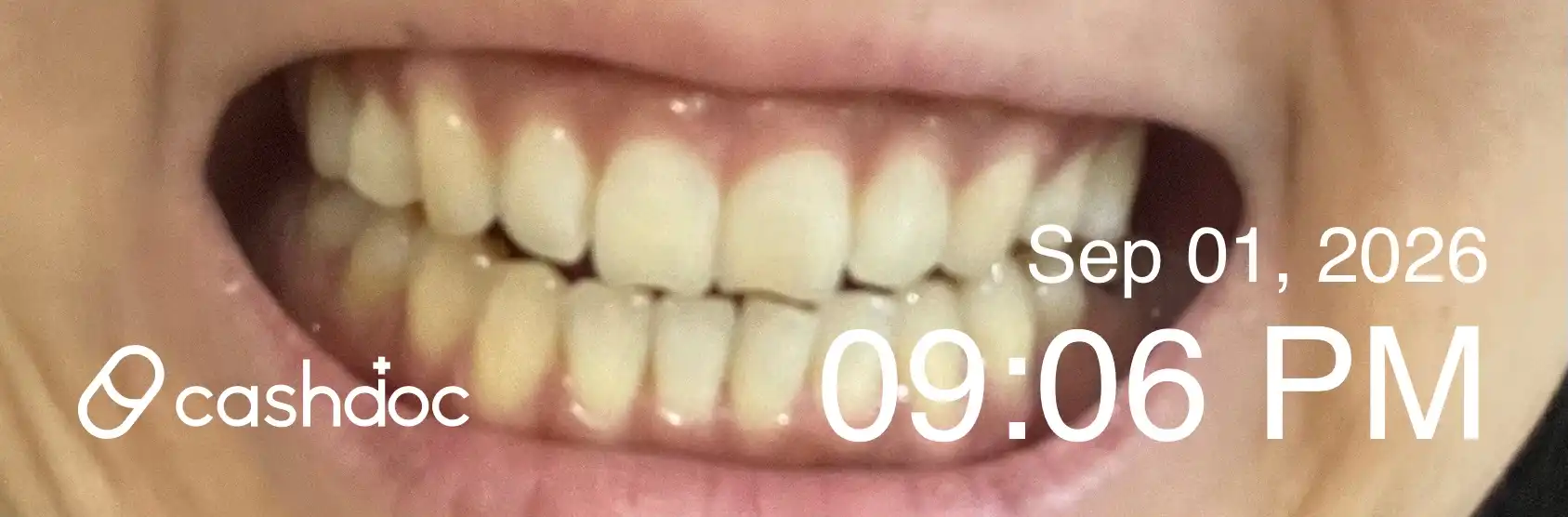Review photo