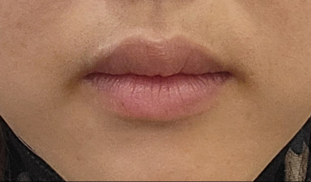 Before