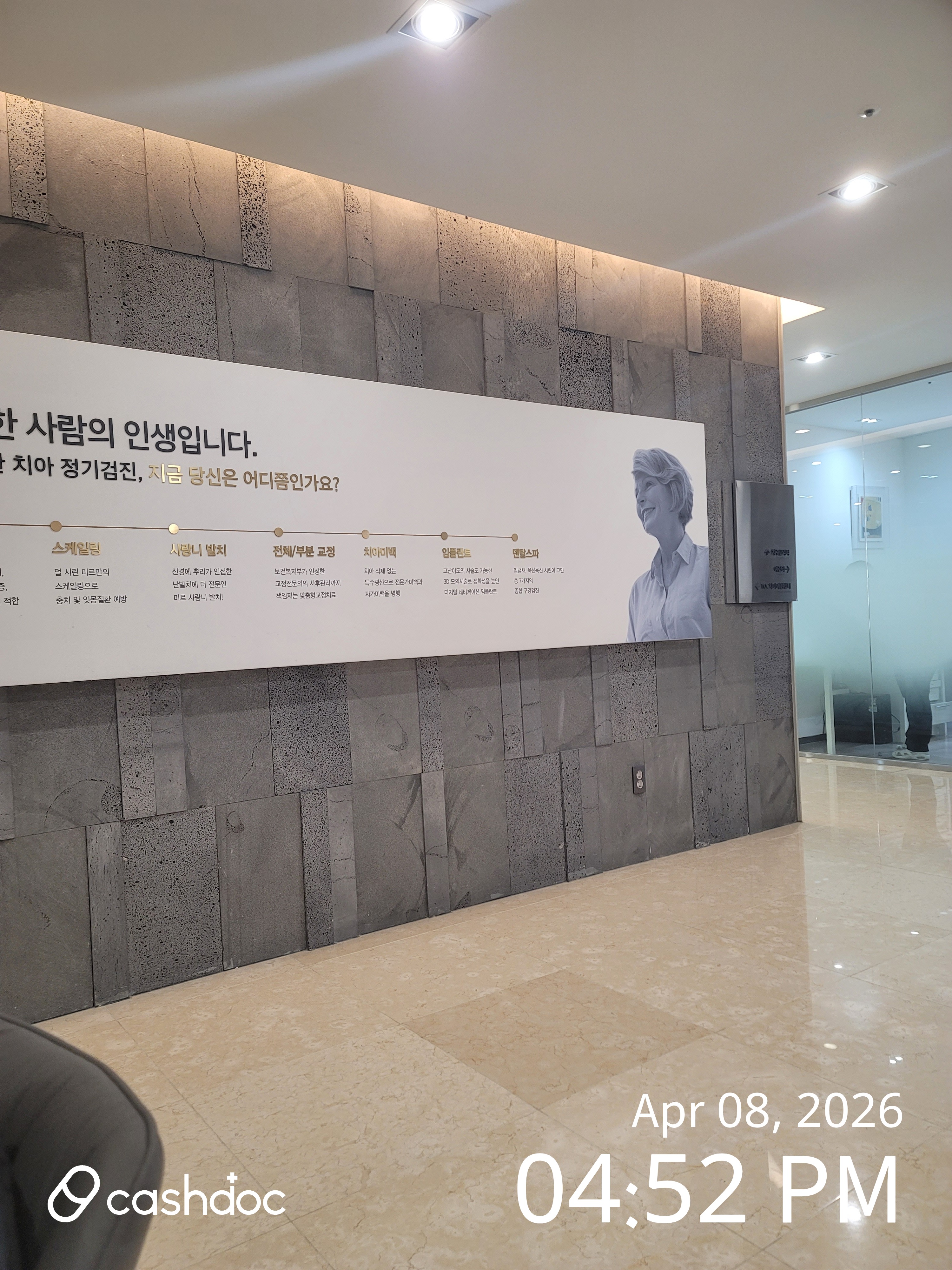 중구 미르치과병원, 스케일링 경험이 편안했어요