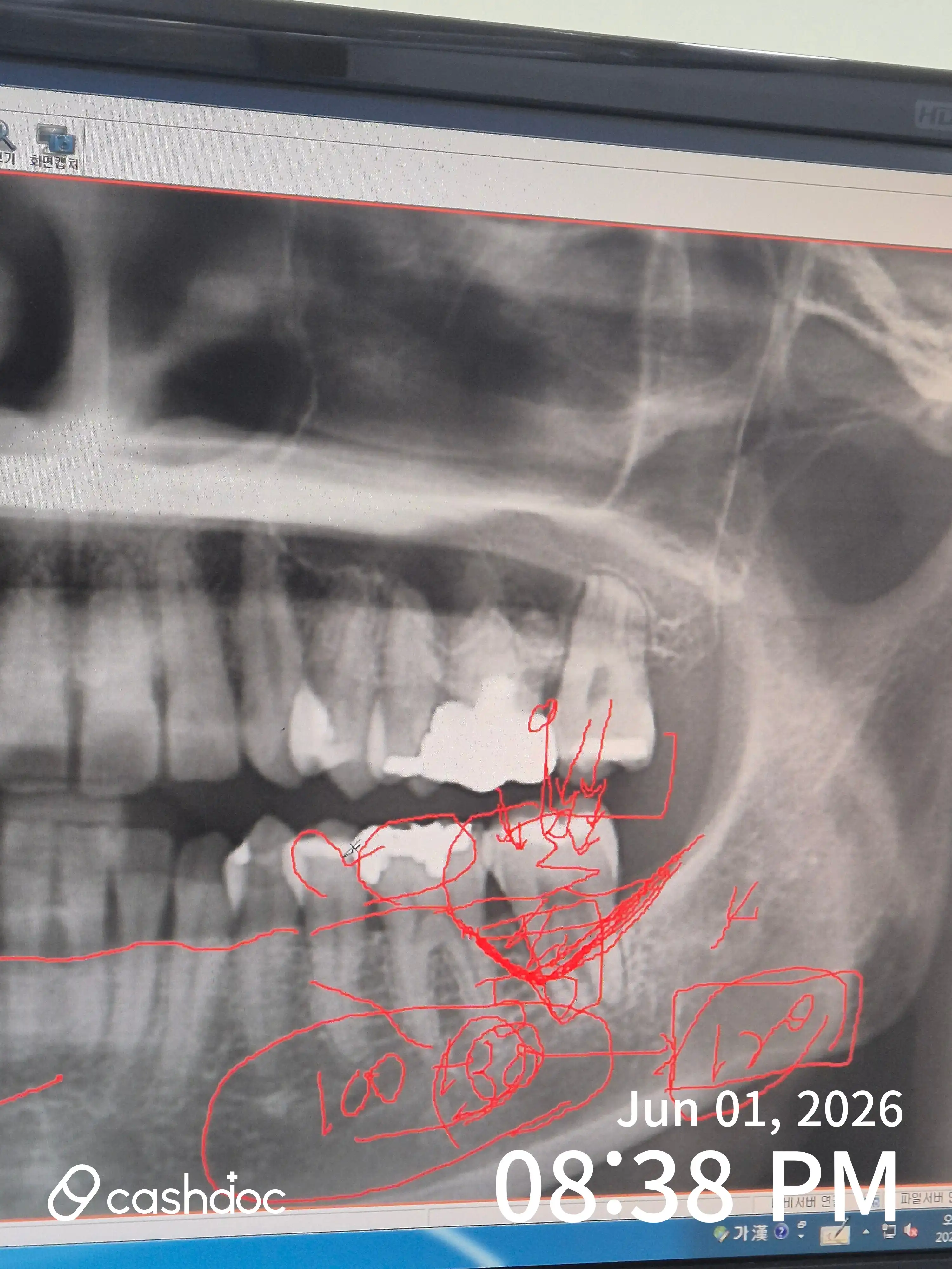 Review photo
