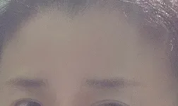 시술 전 — 안개눈썹 리터치 무제한 이벤트