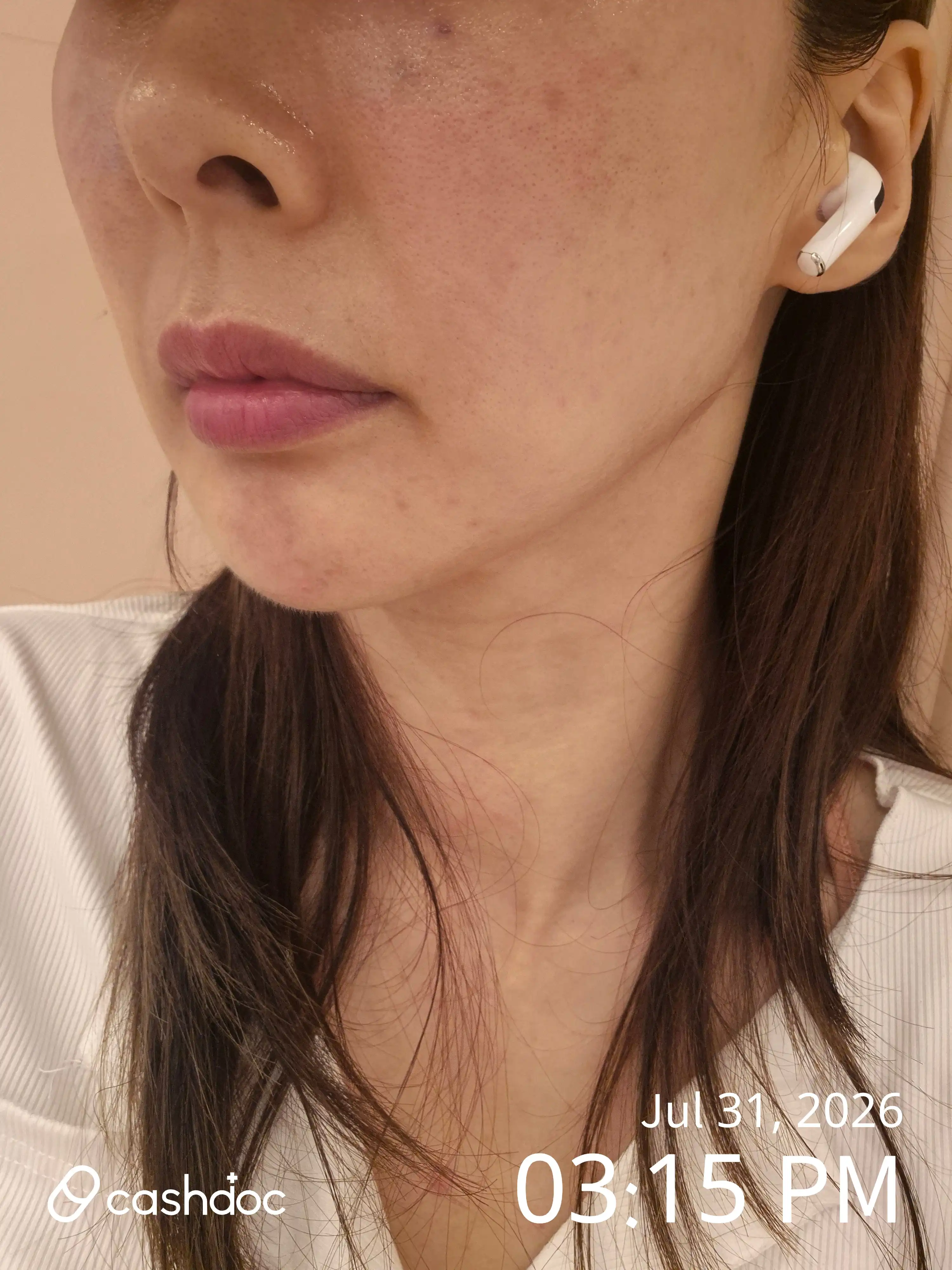 评价照片