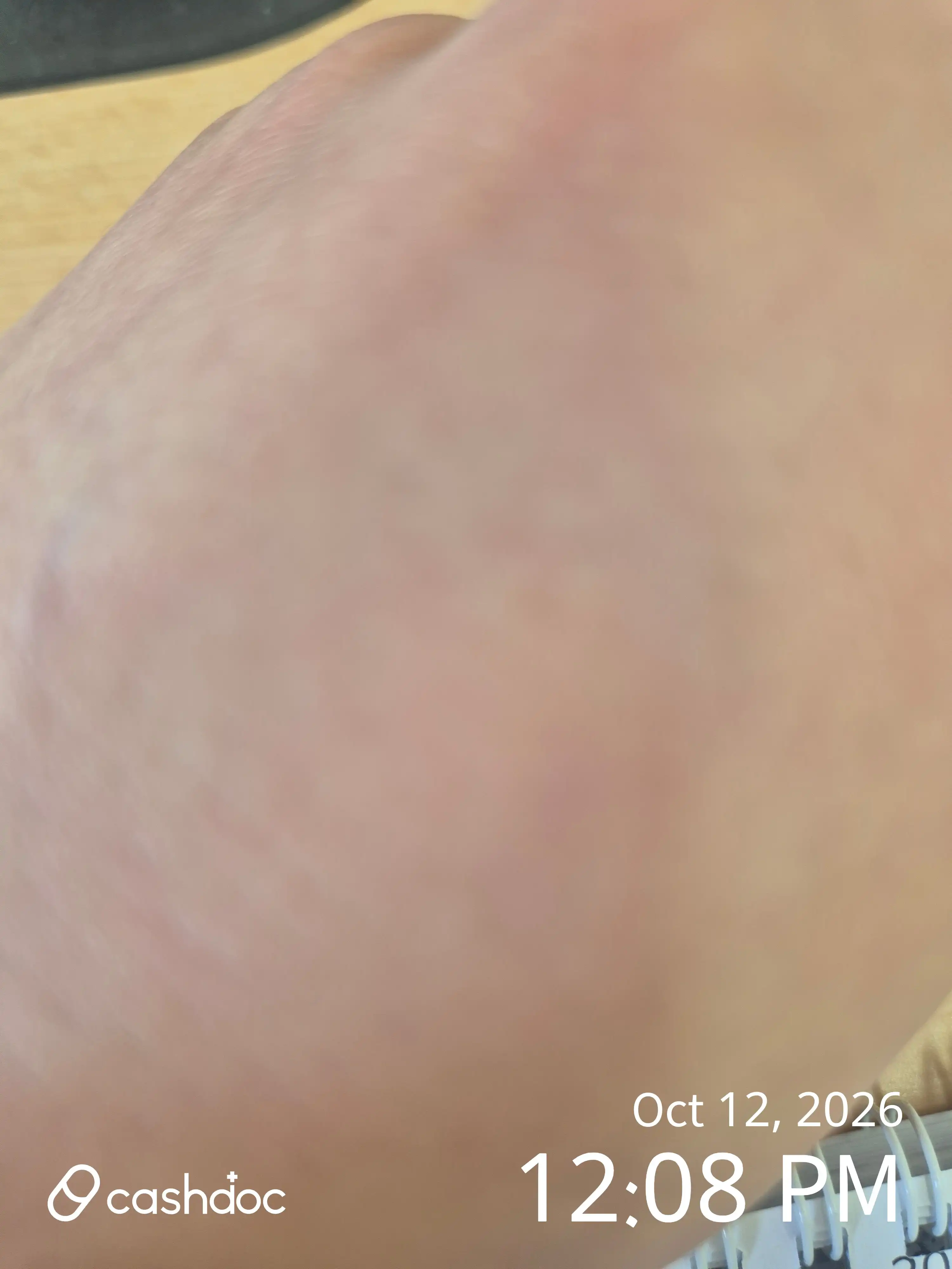 Review photo