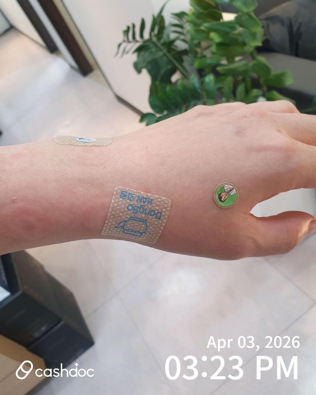 안산시 동보한의원에서 치료받고 손목 통증 덜어요