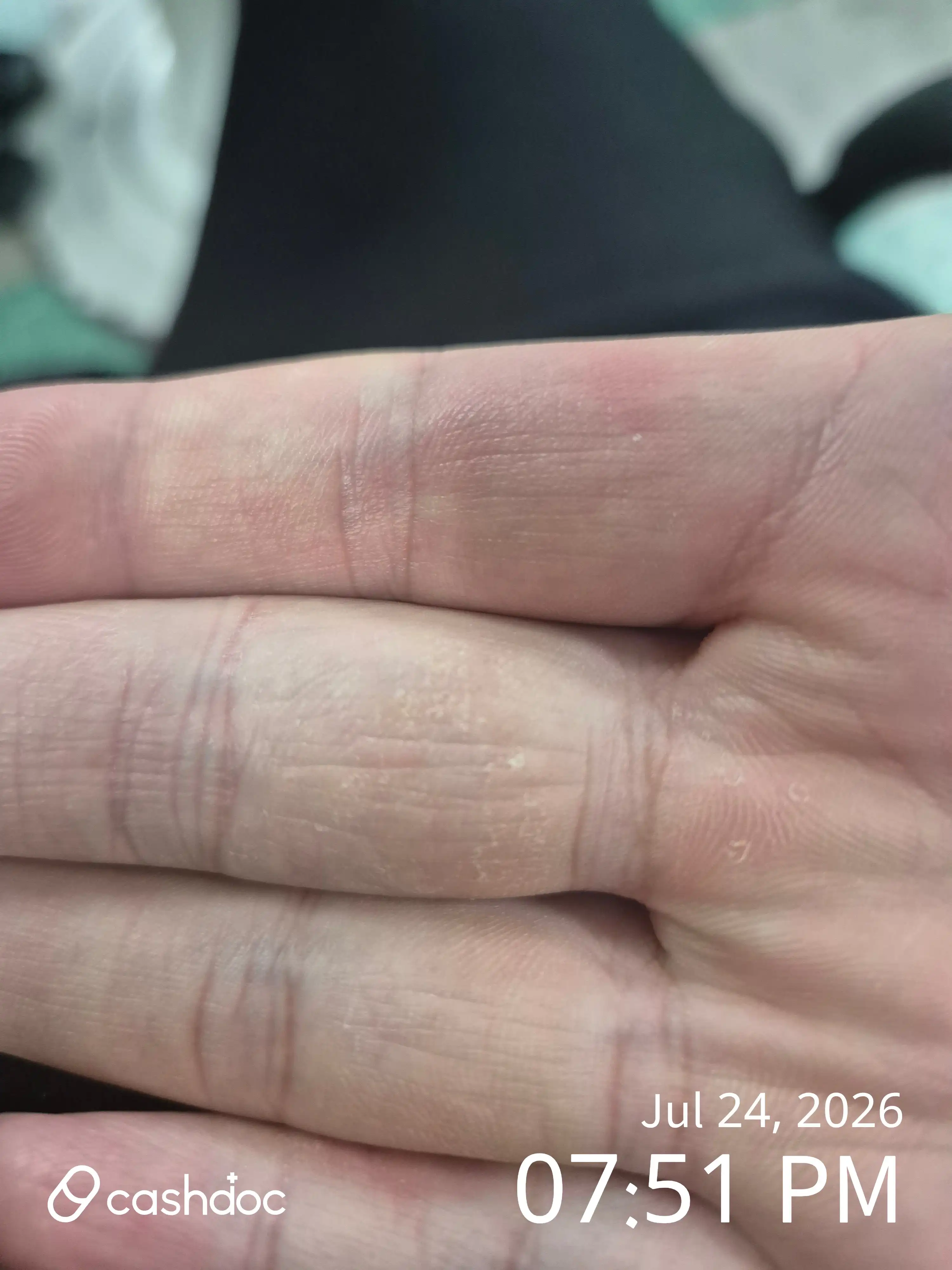 评价照片