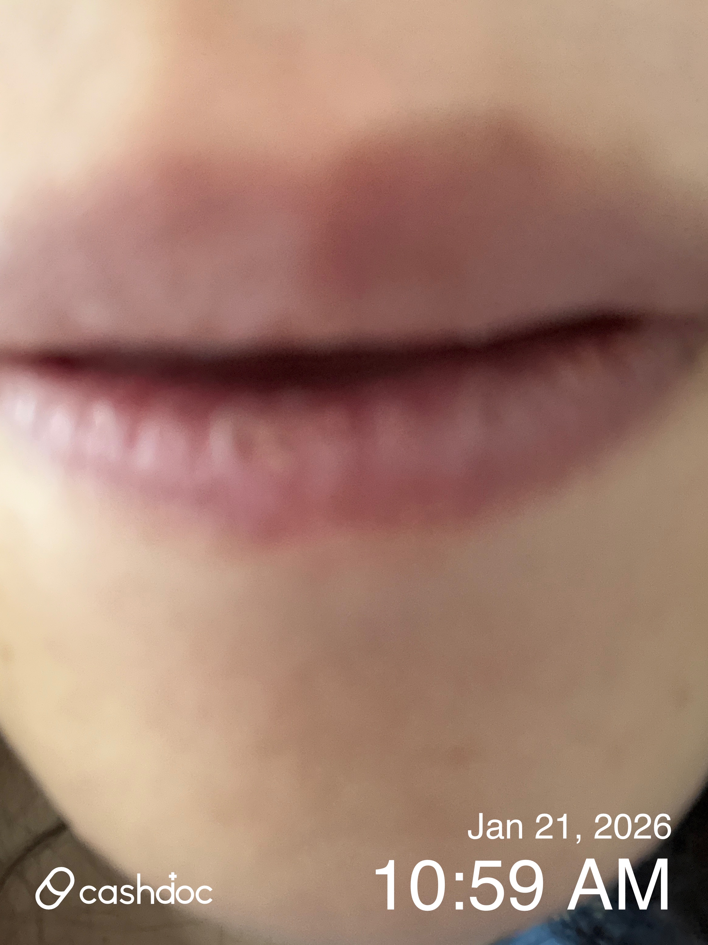 진주시 미미썸의원, 인중제모 후 만족해 다시 방문할래요