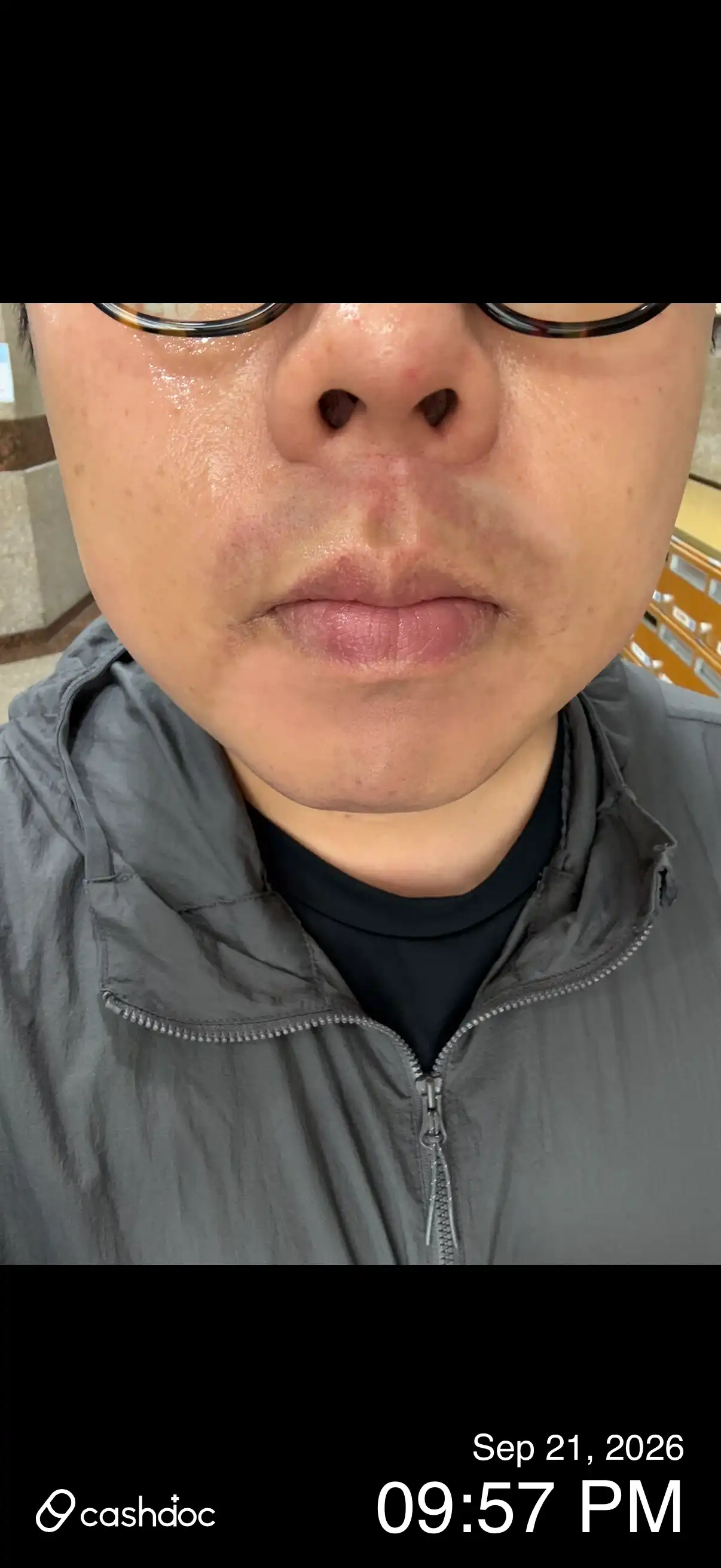 评价照片