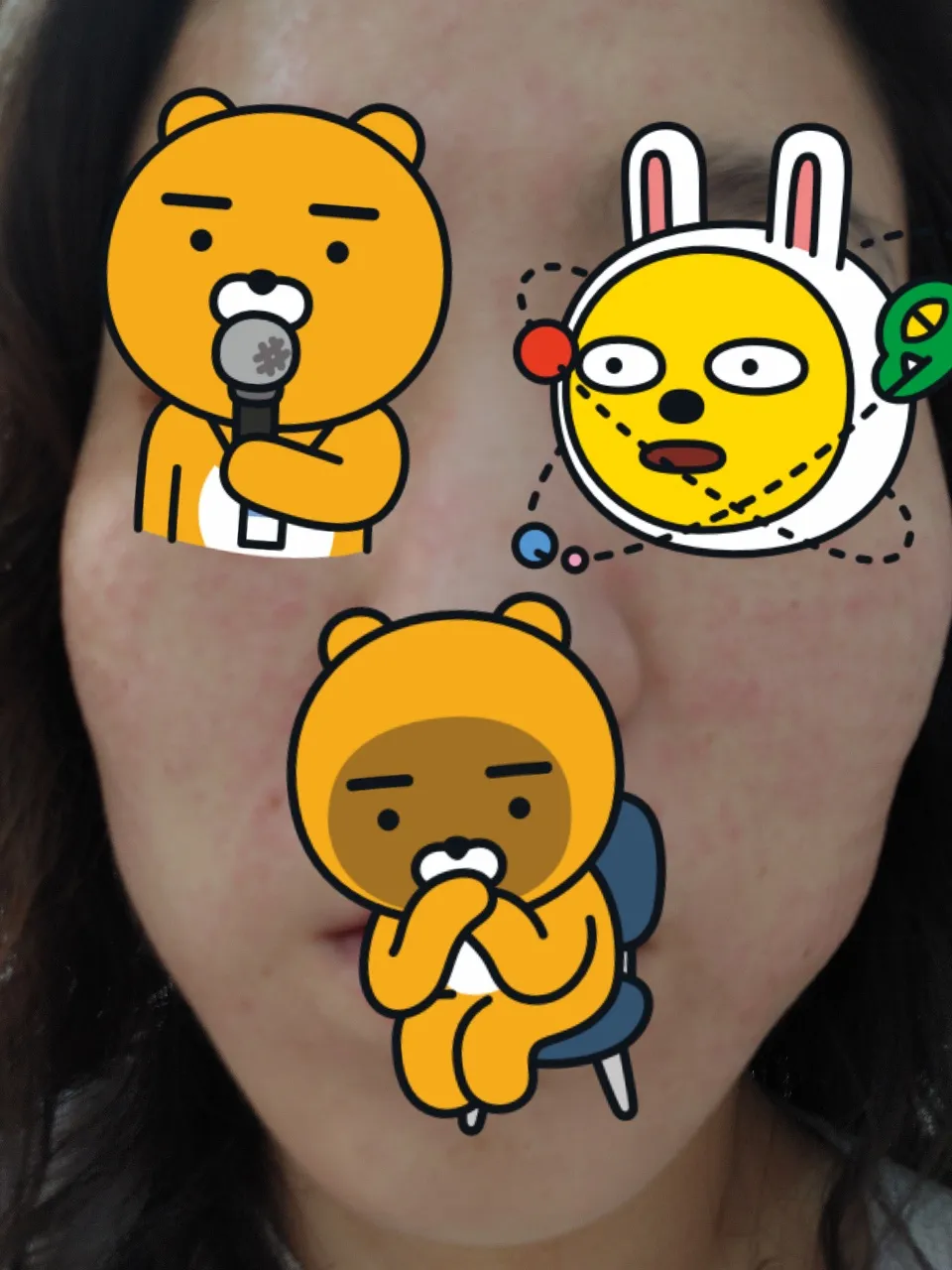After treatment — Pain reduction special #Rejuran Healer
