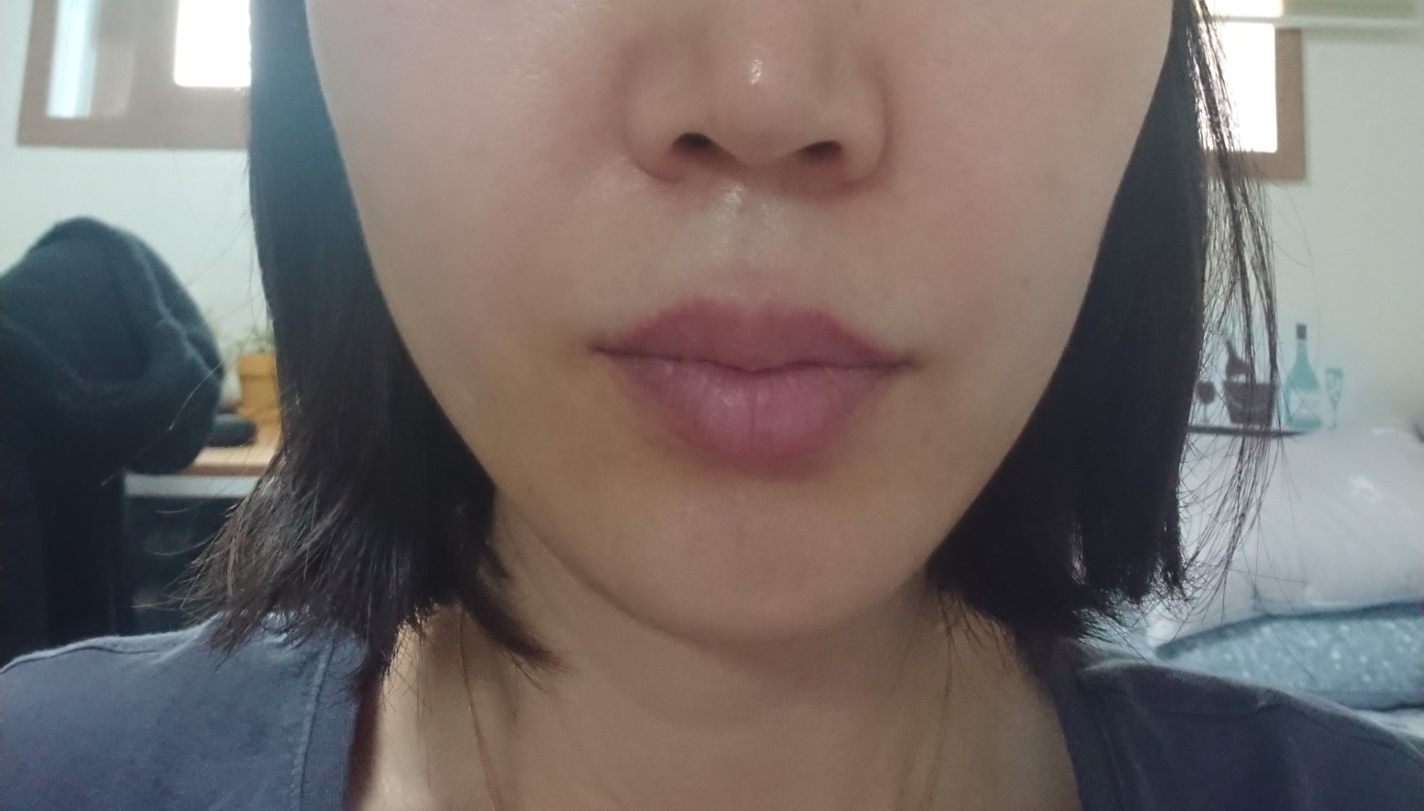 시술 전 — 생기있는 톤업 입술반영구