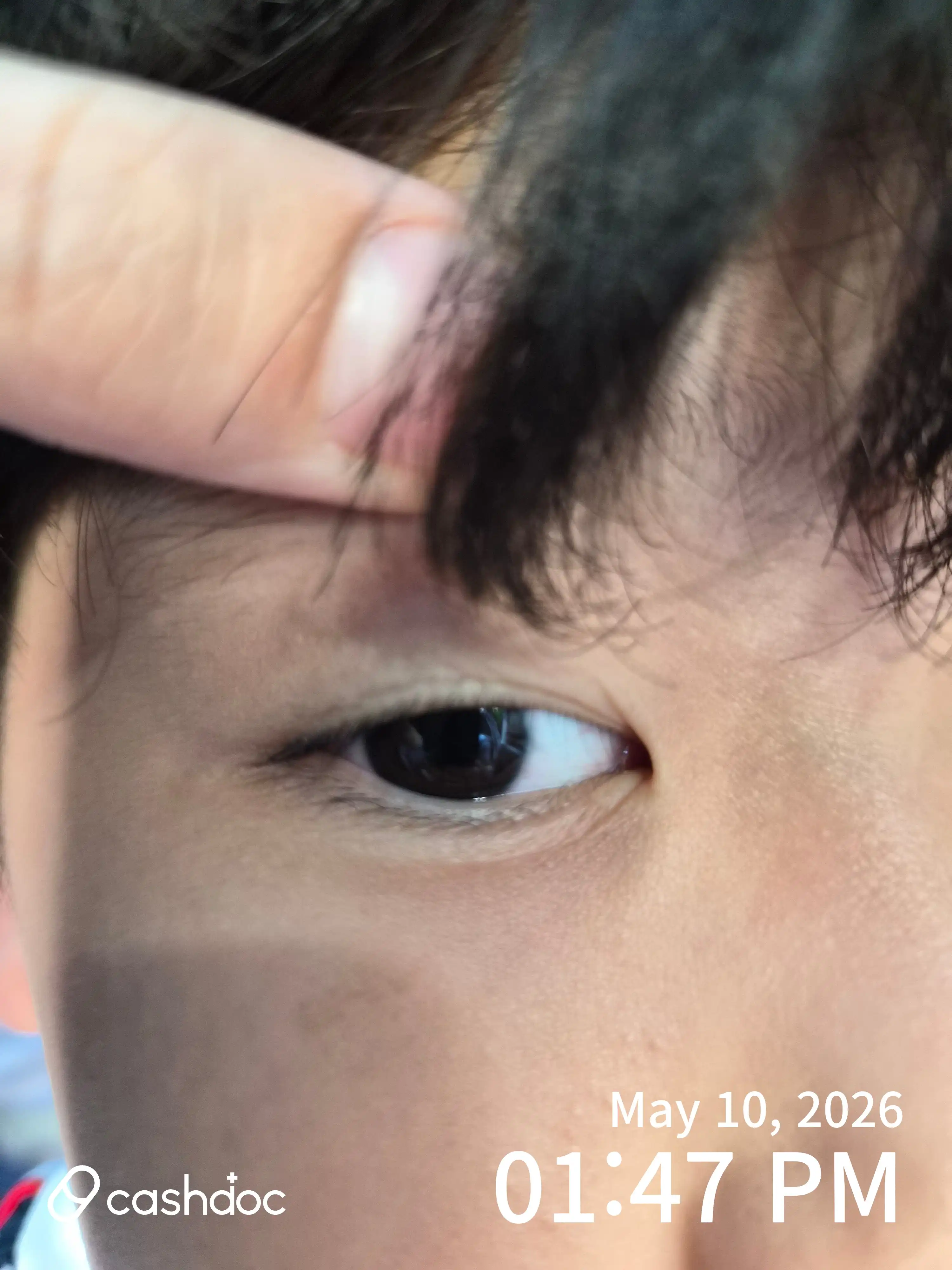 Review photo