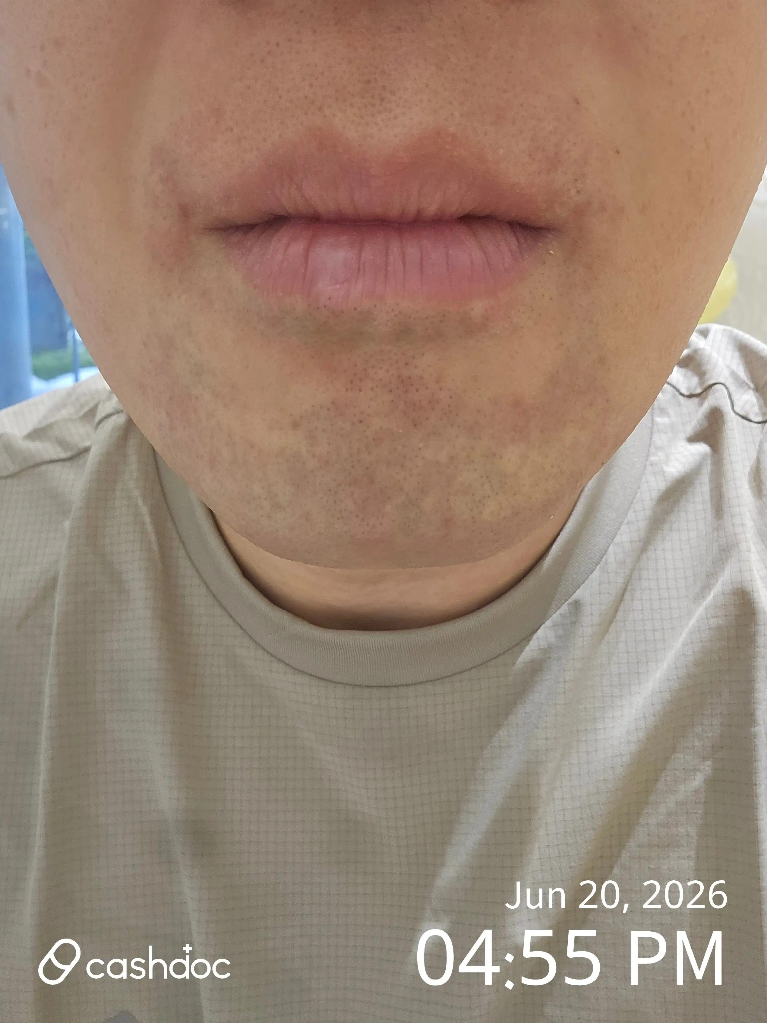 Review photo