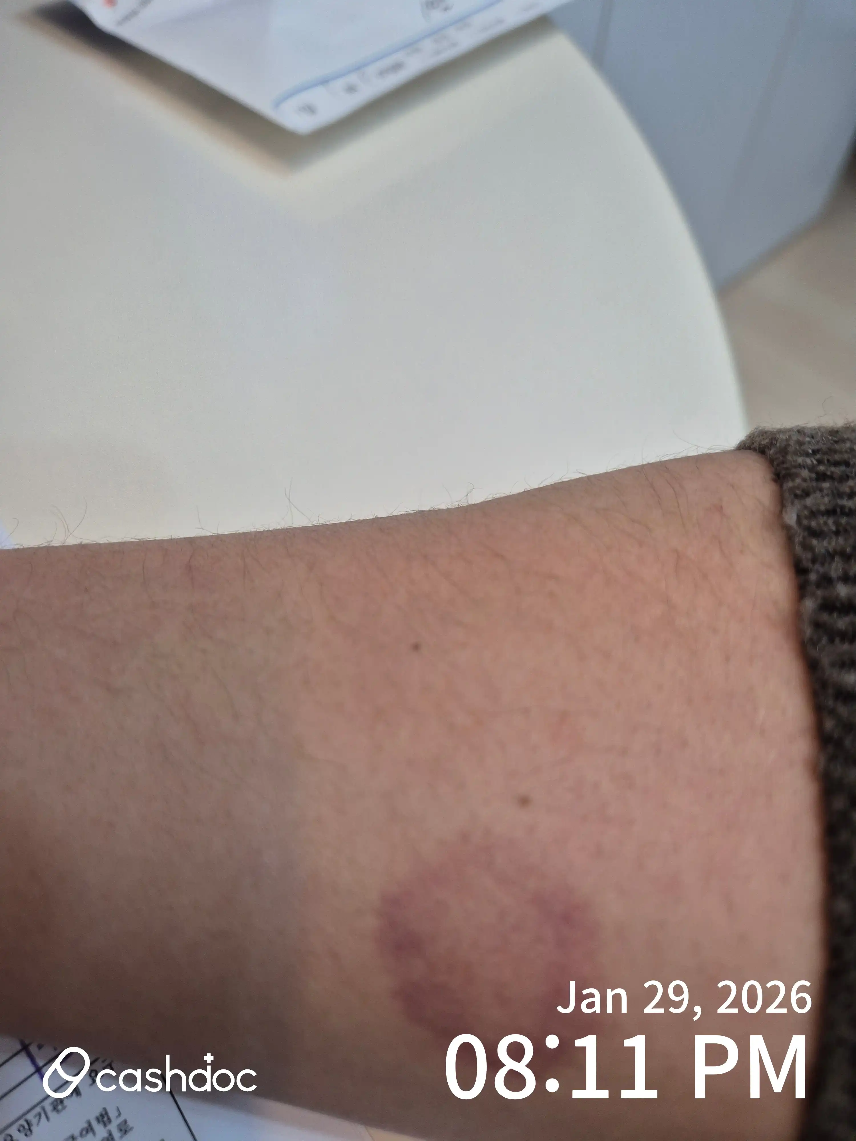 Review photo