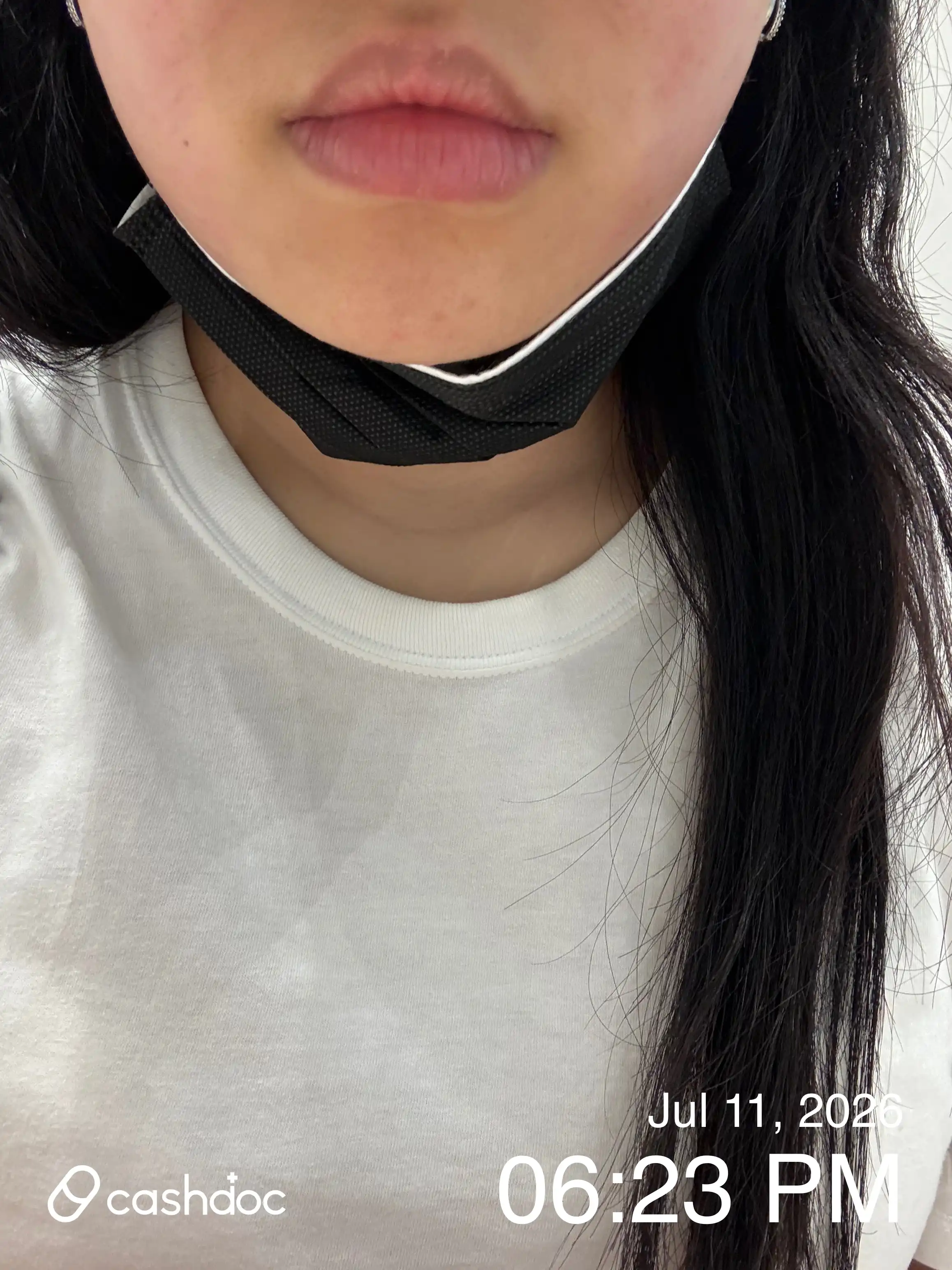 レビュー写真