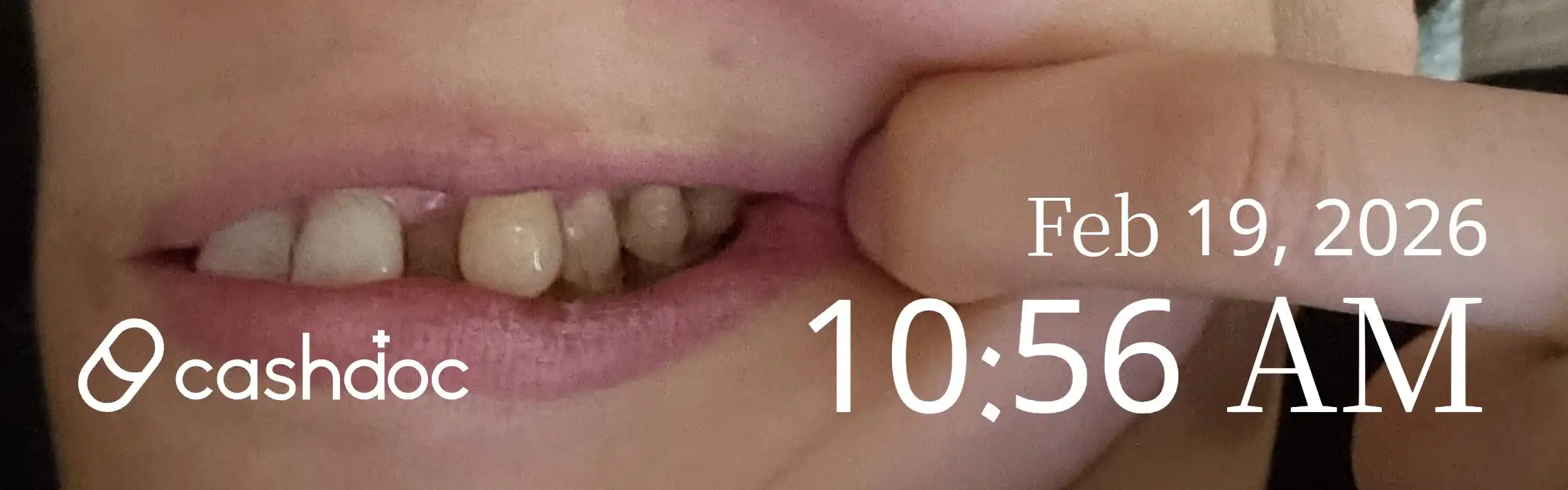 Review photo