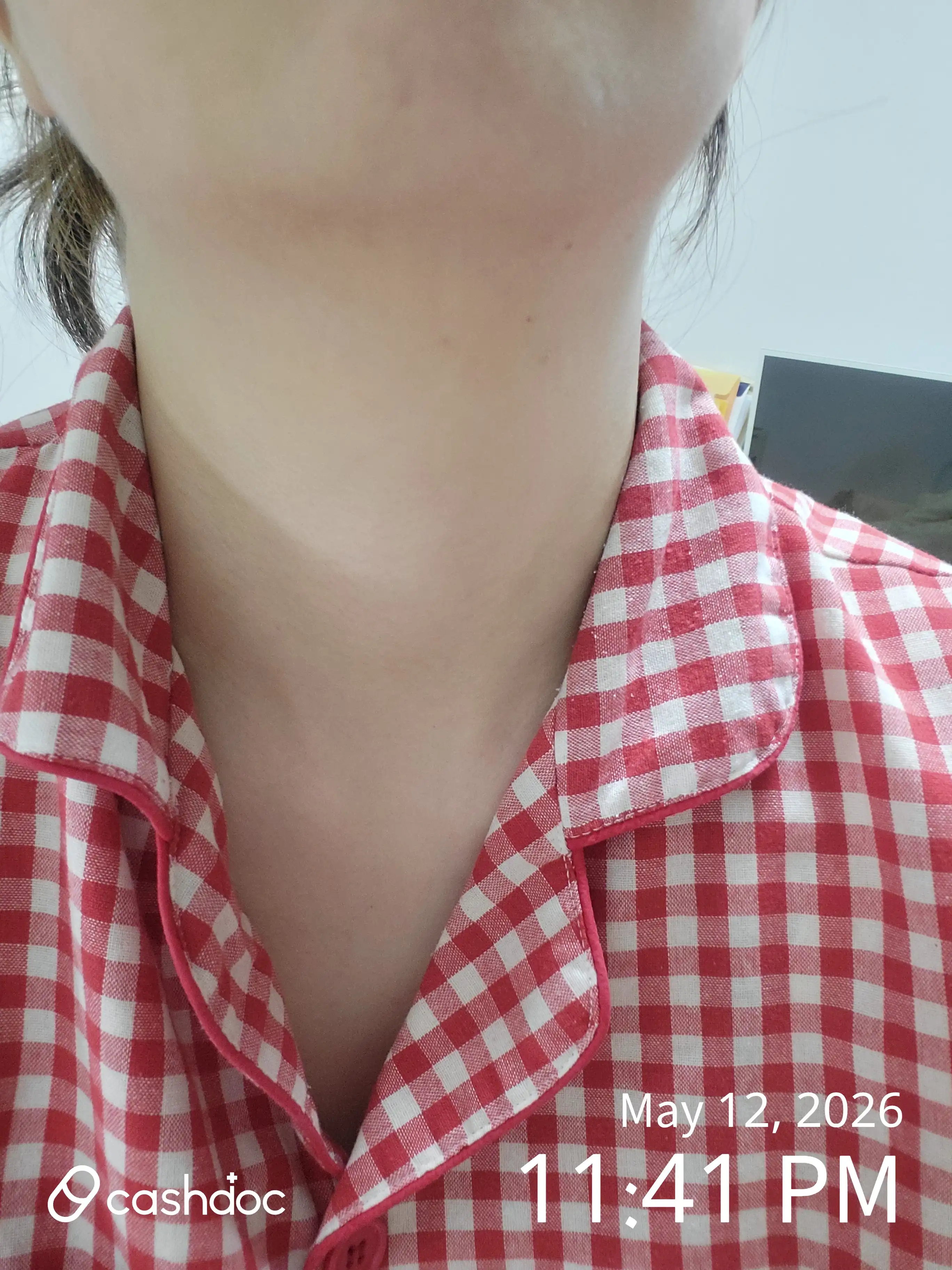 评价照片