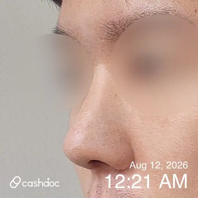 レビュー写真