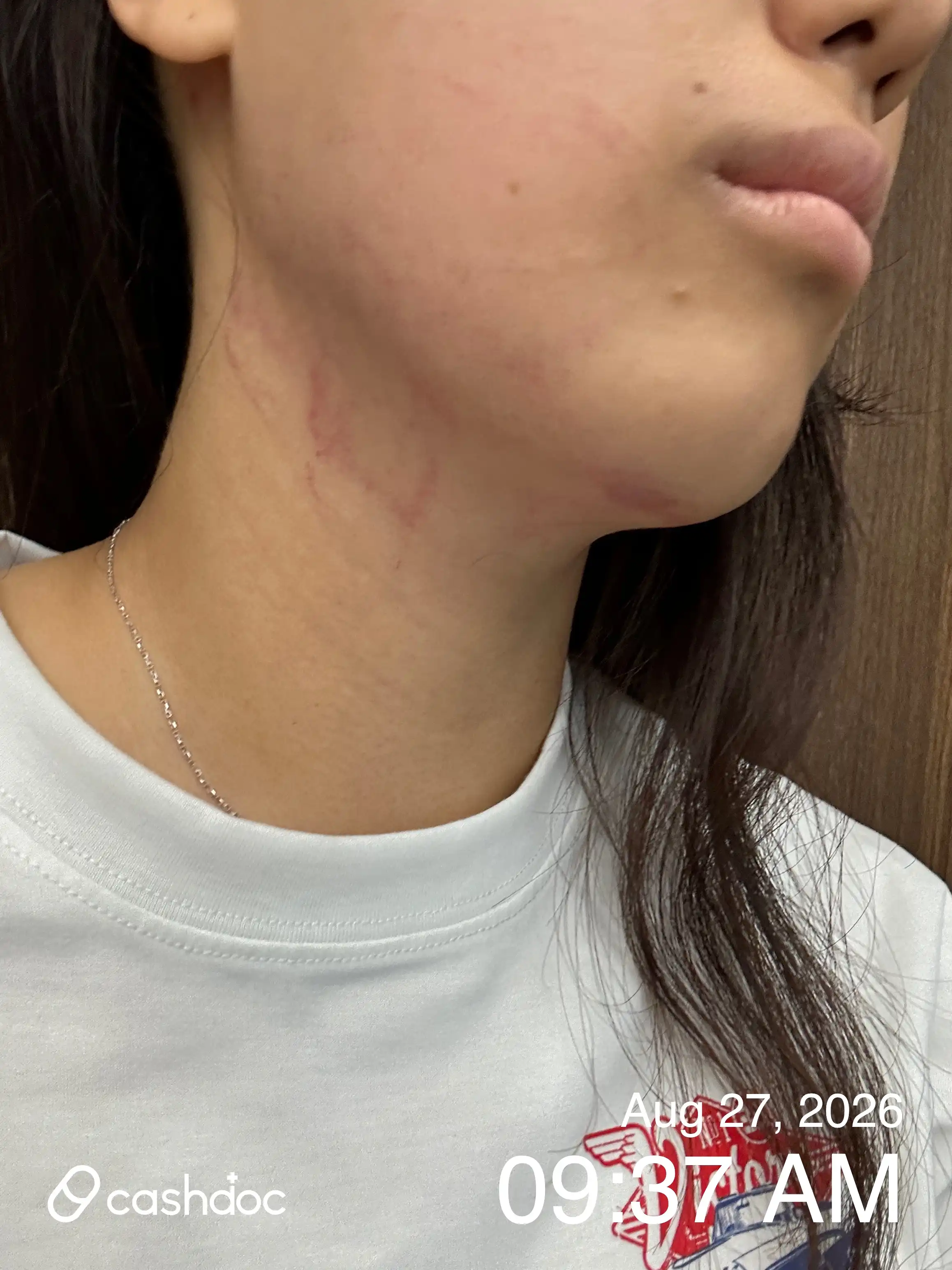 评价照片