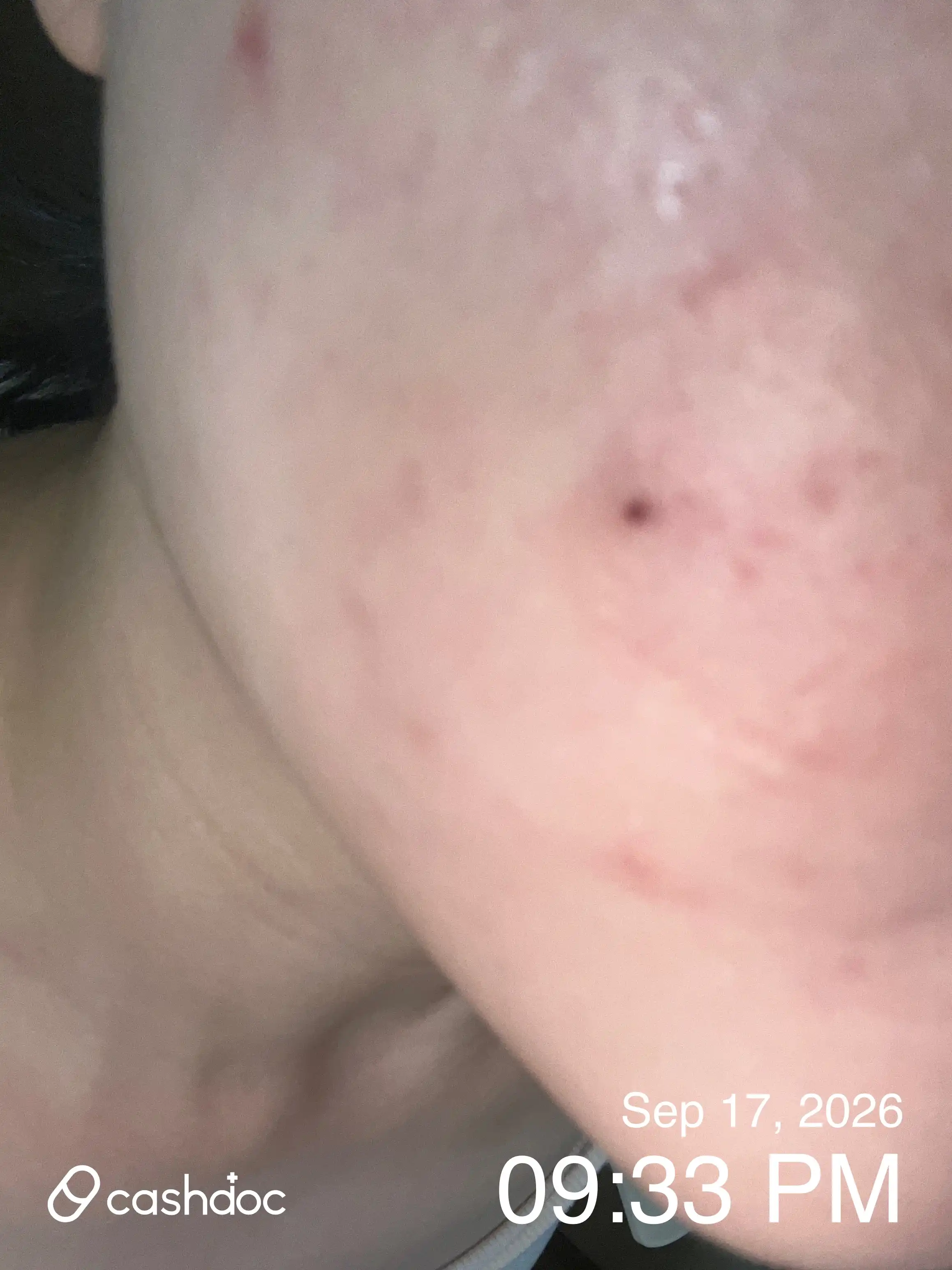 Review photo