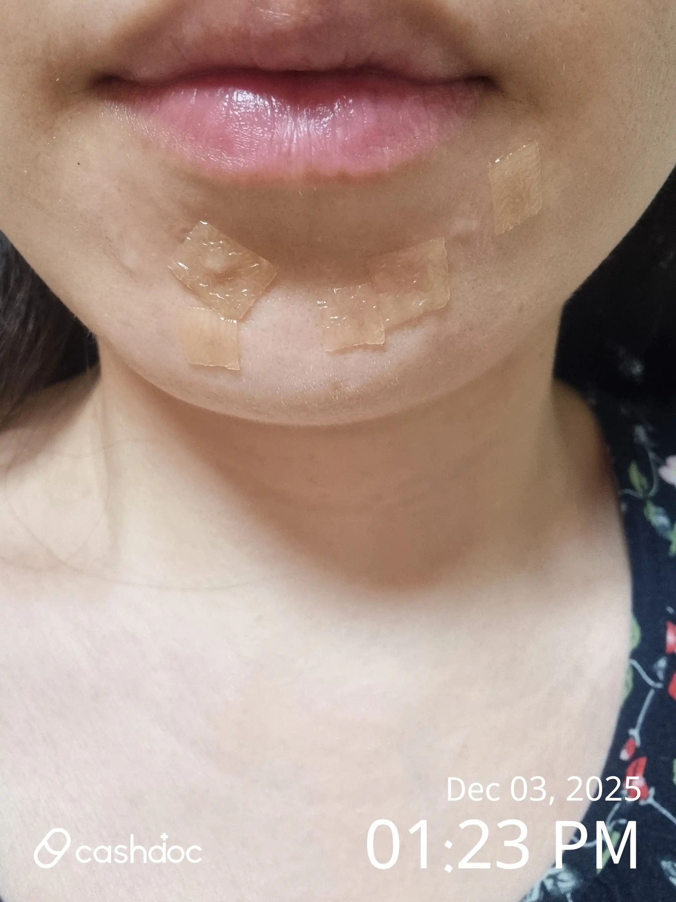 评价照片