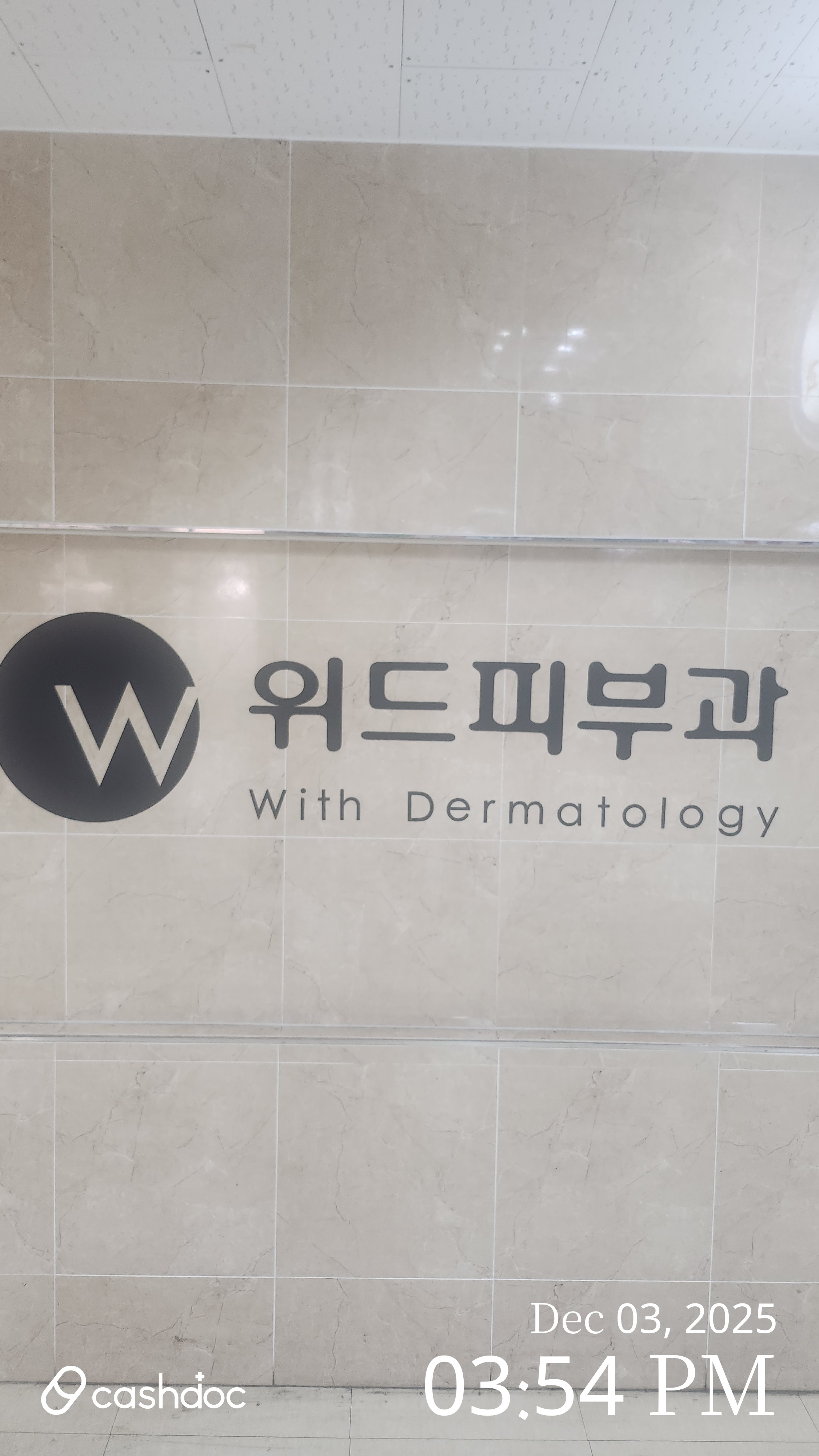 스트레스로 인한 원형탈모, 서울 위드피부과의원에서 레이저와 주사 치료 후기 - 점진적 호전 중