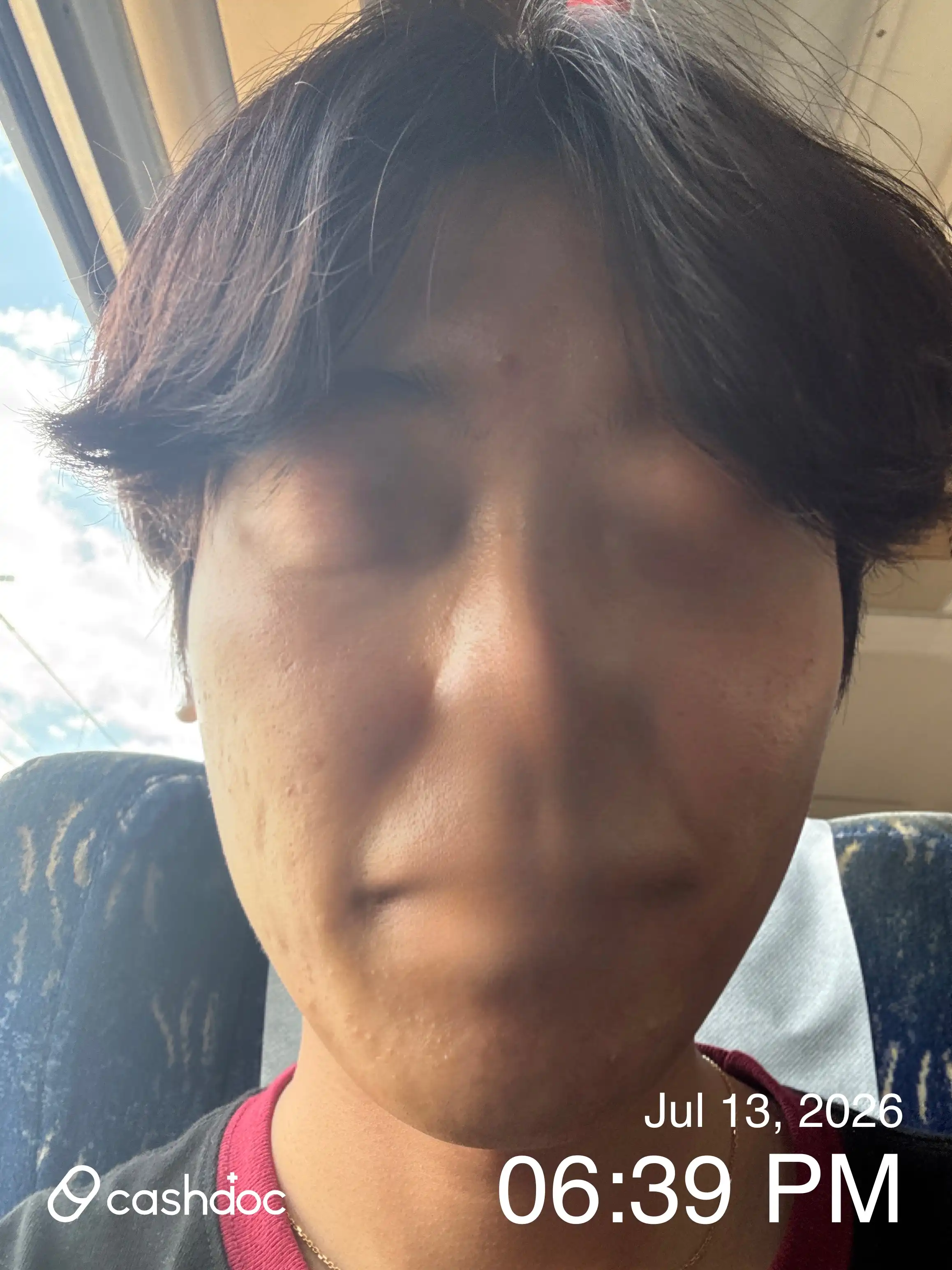 レビュー写真