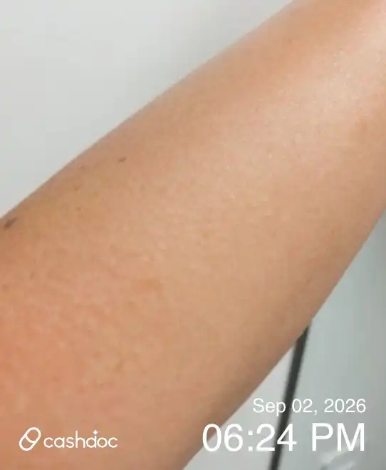 Review photo