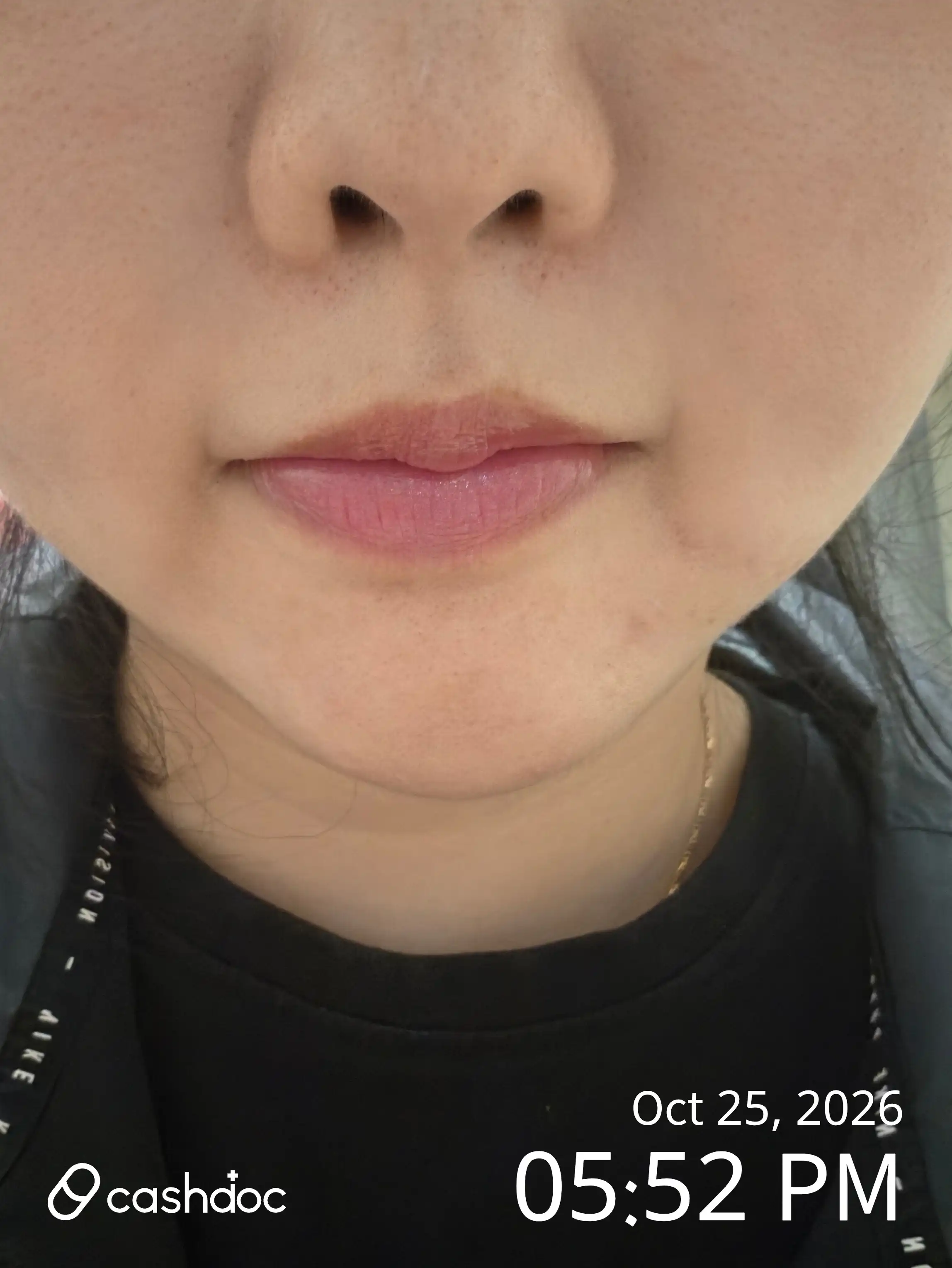 Mei Pure Clinic Inha University Station Branch review photo