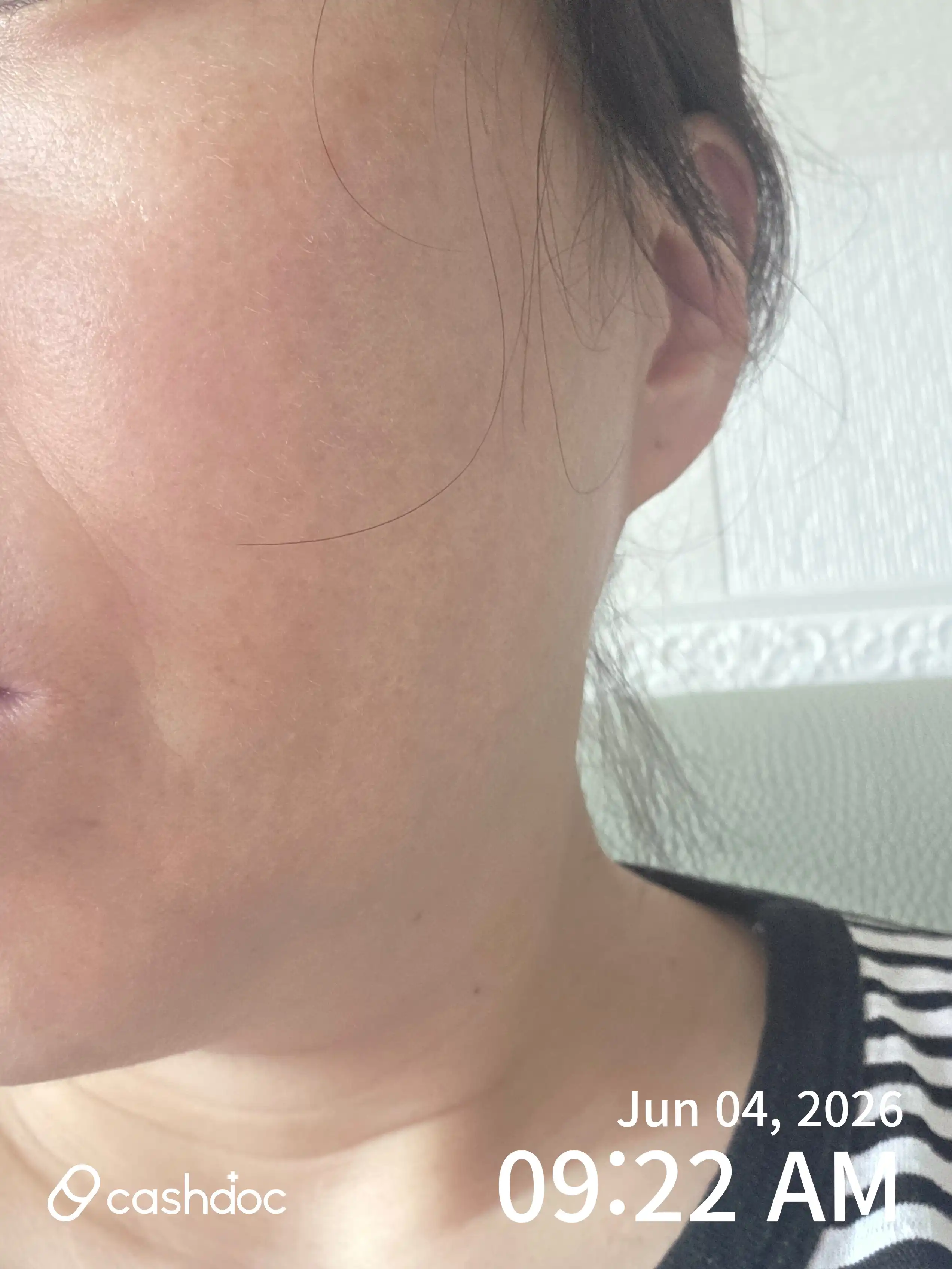 评价照片