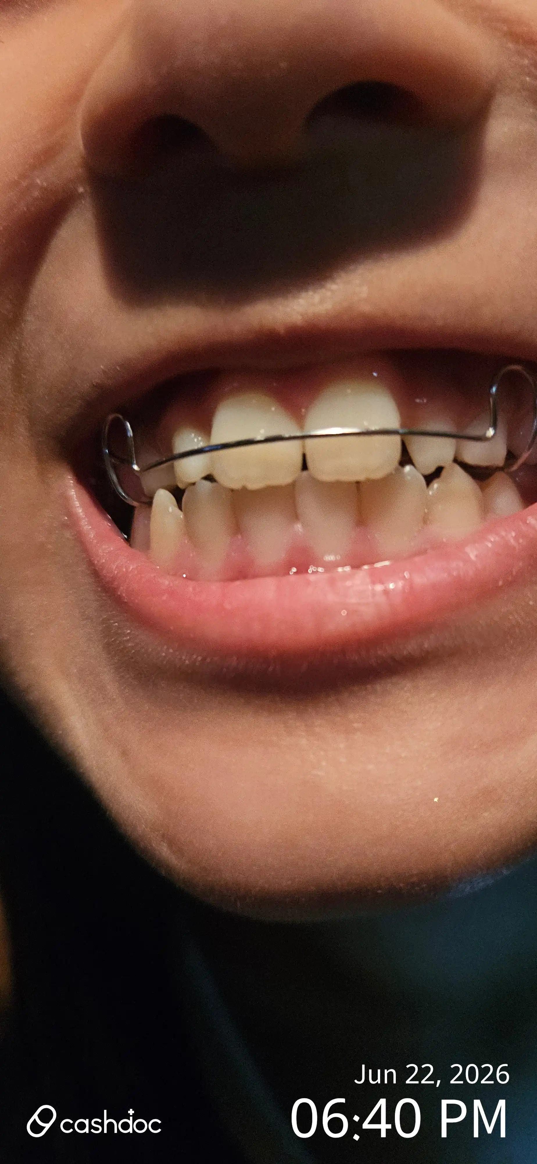 Review photo
