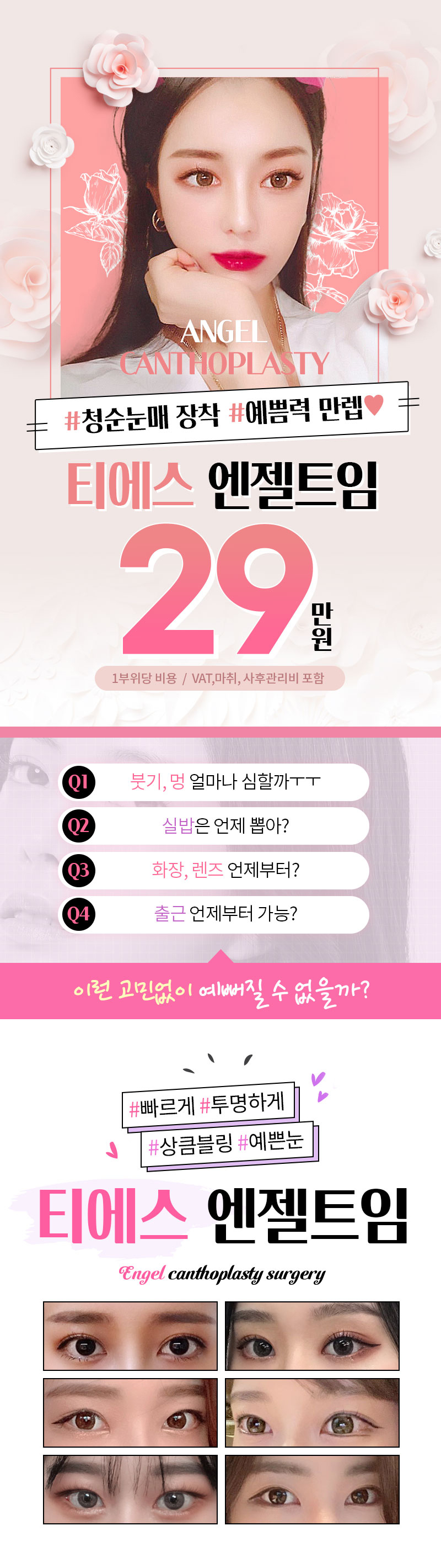 티에스성형외과 티에스 엔젤트임 이벤트, 시술 상세 이미지
