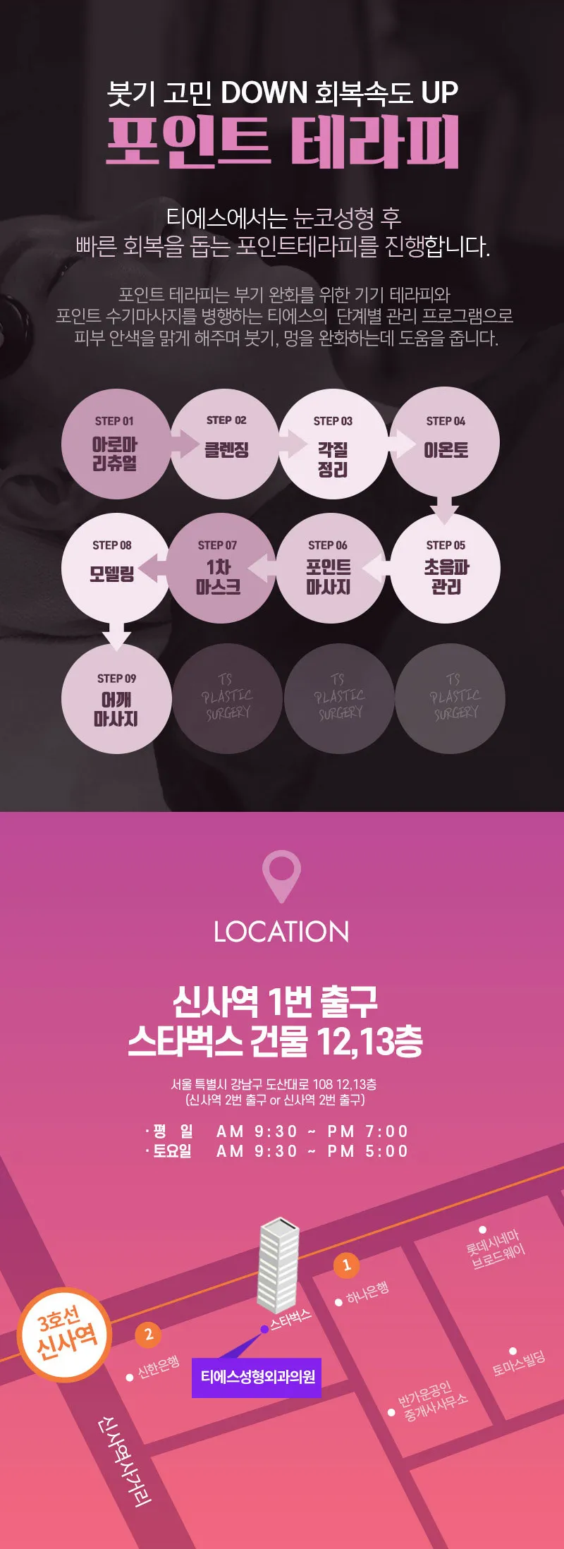 티에스성형외과 티에스 첫눈 3컨셉 자연유착 이벤트, 시술 상세 이미지