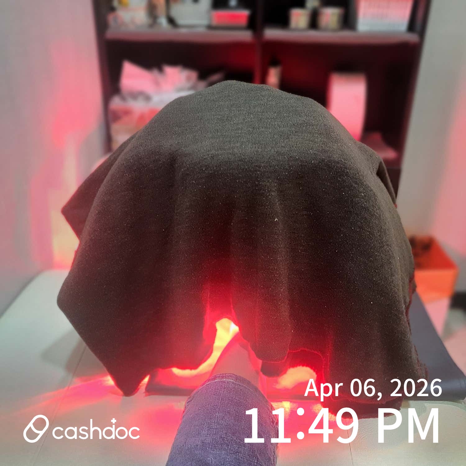 남동구 지오피부과에서 받은 맞춤형 피부 재생광선 치료 후기