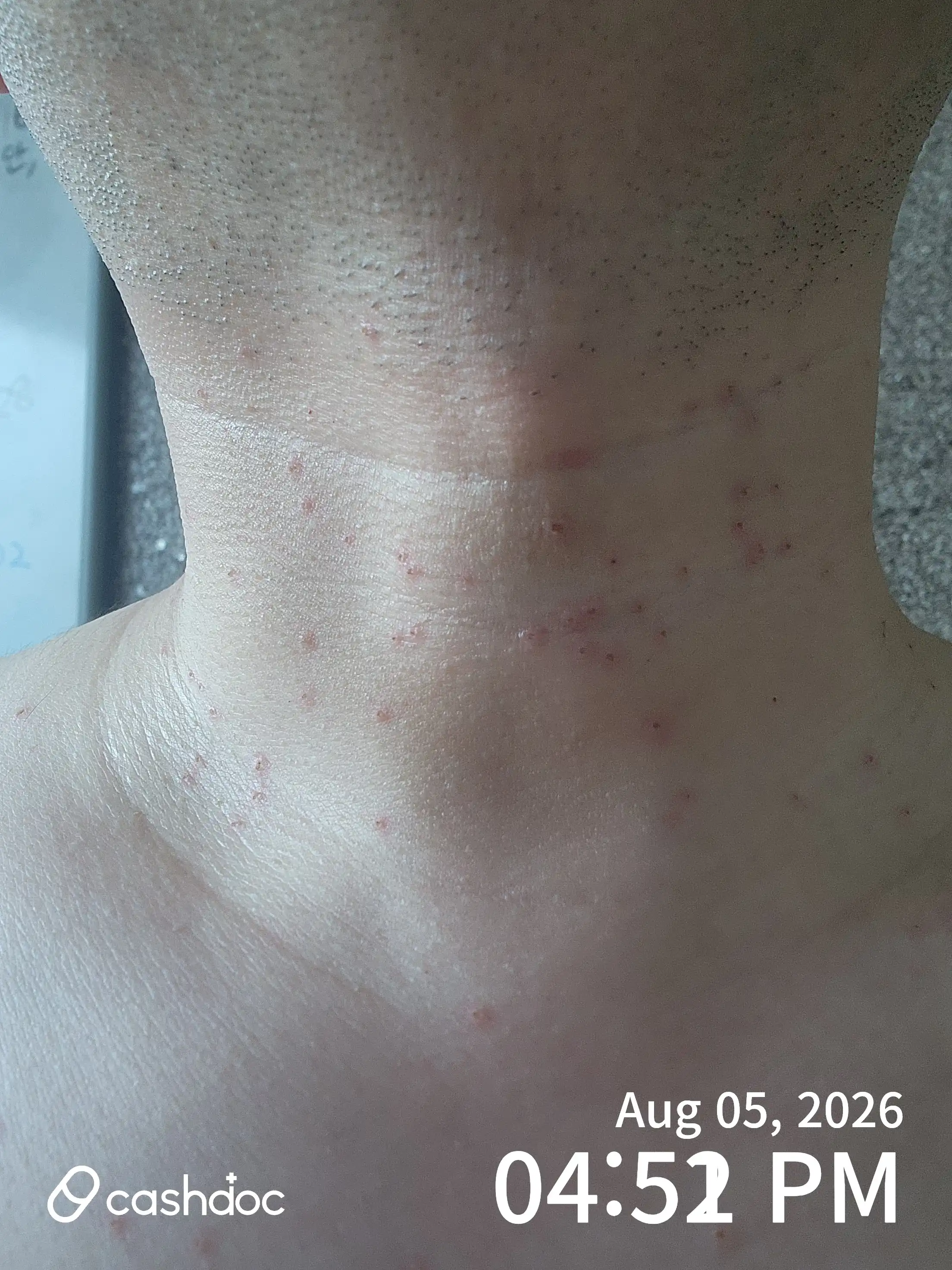 Review photo