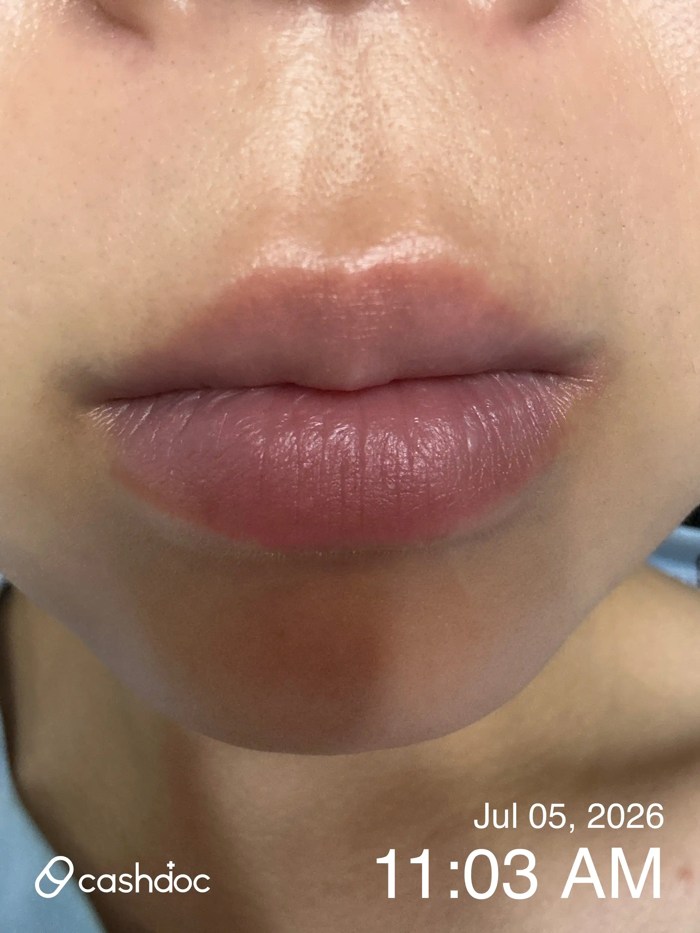 Review photo