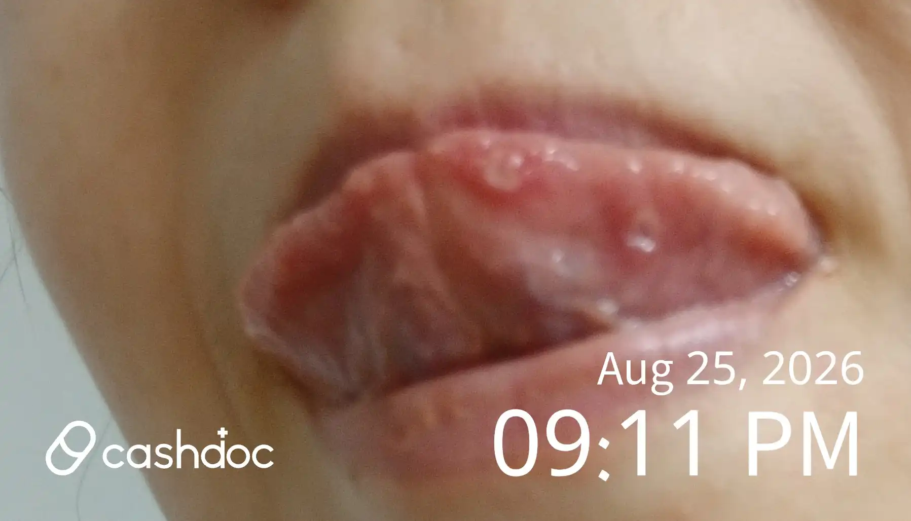 Review photo
