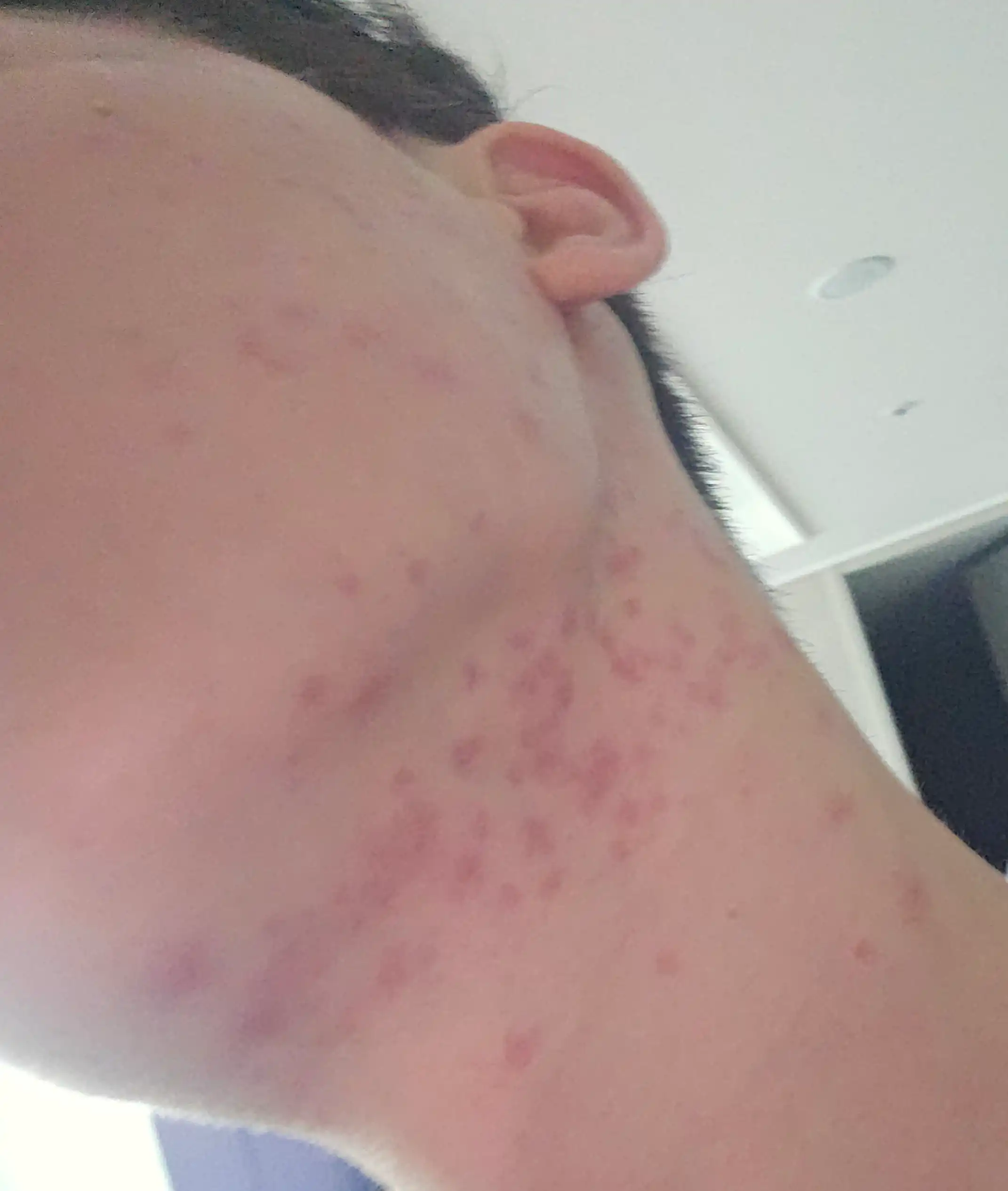 评价照片