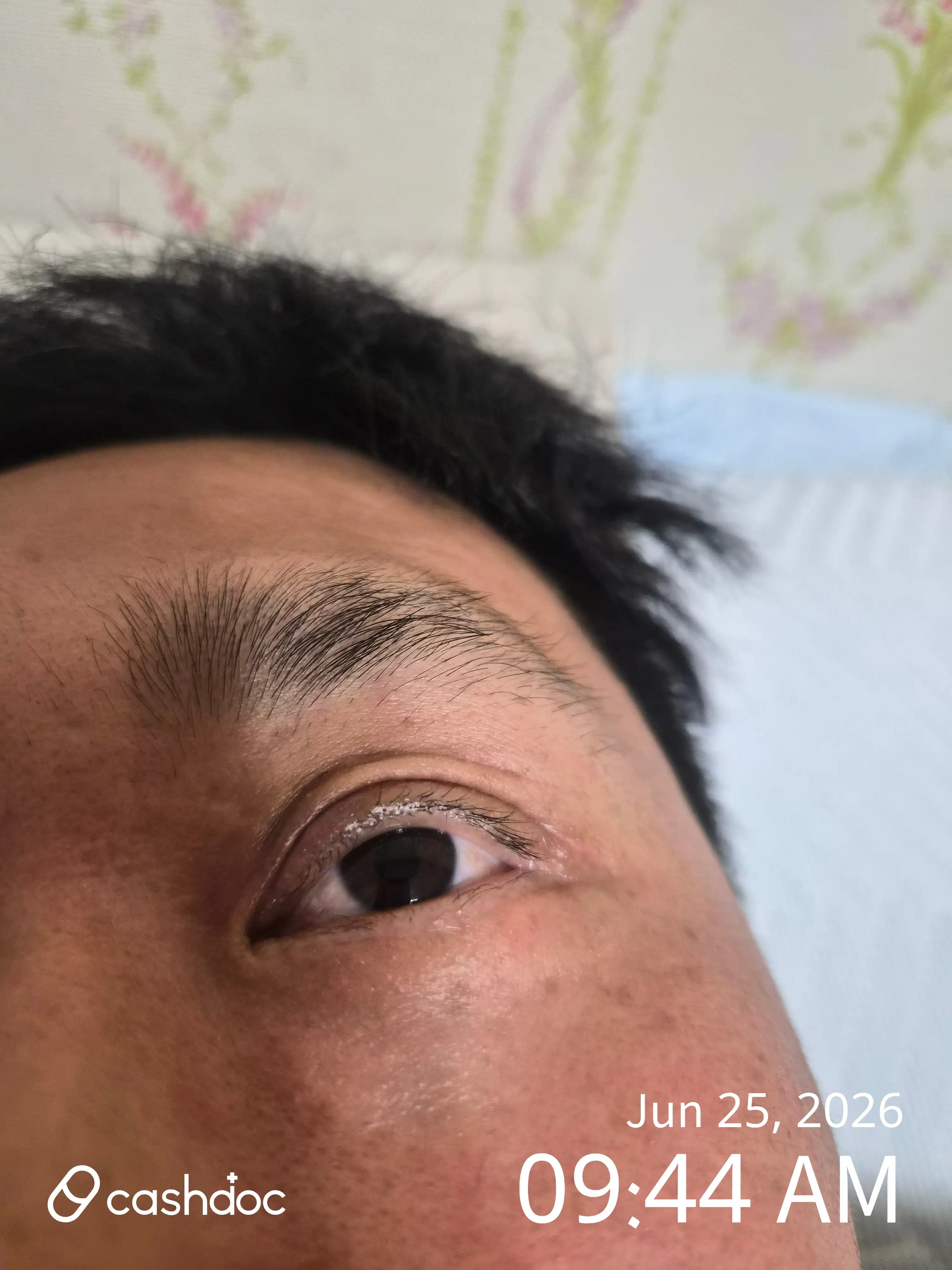 レビュー写真