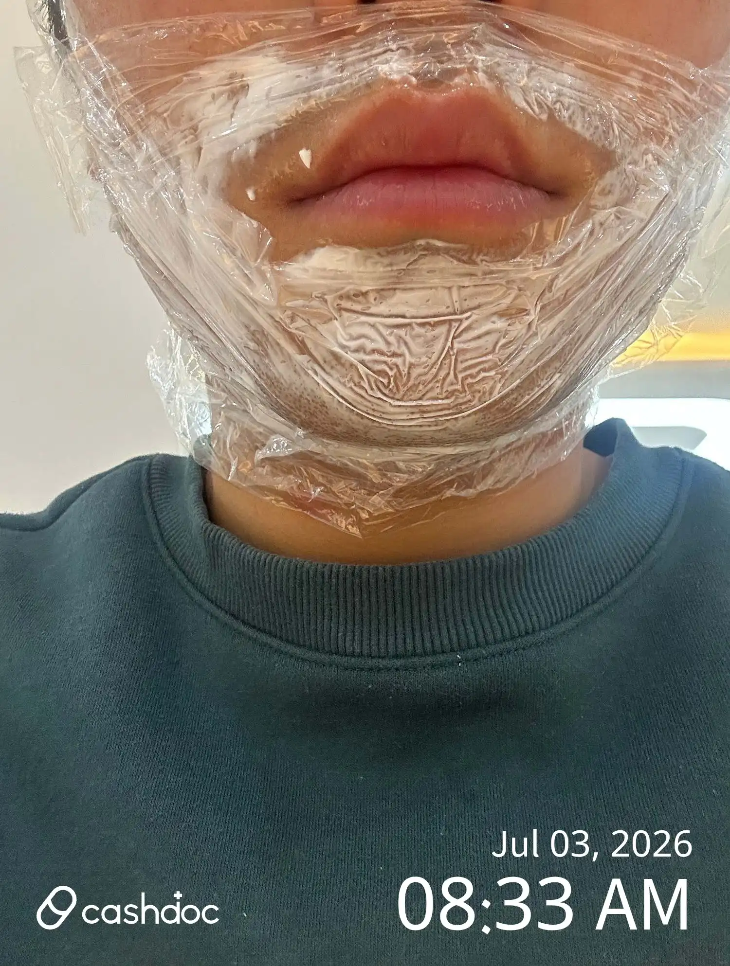 レビュー写真
