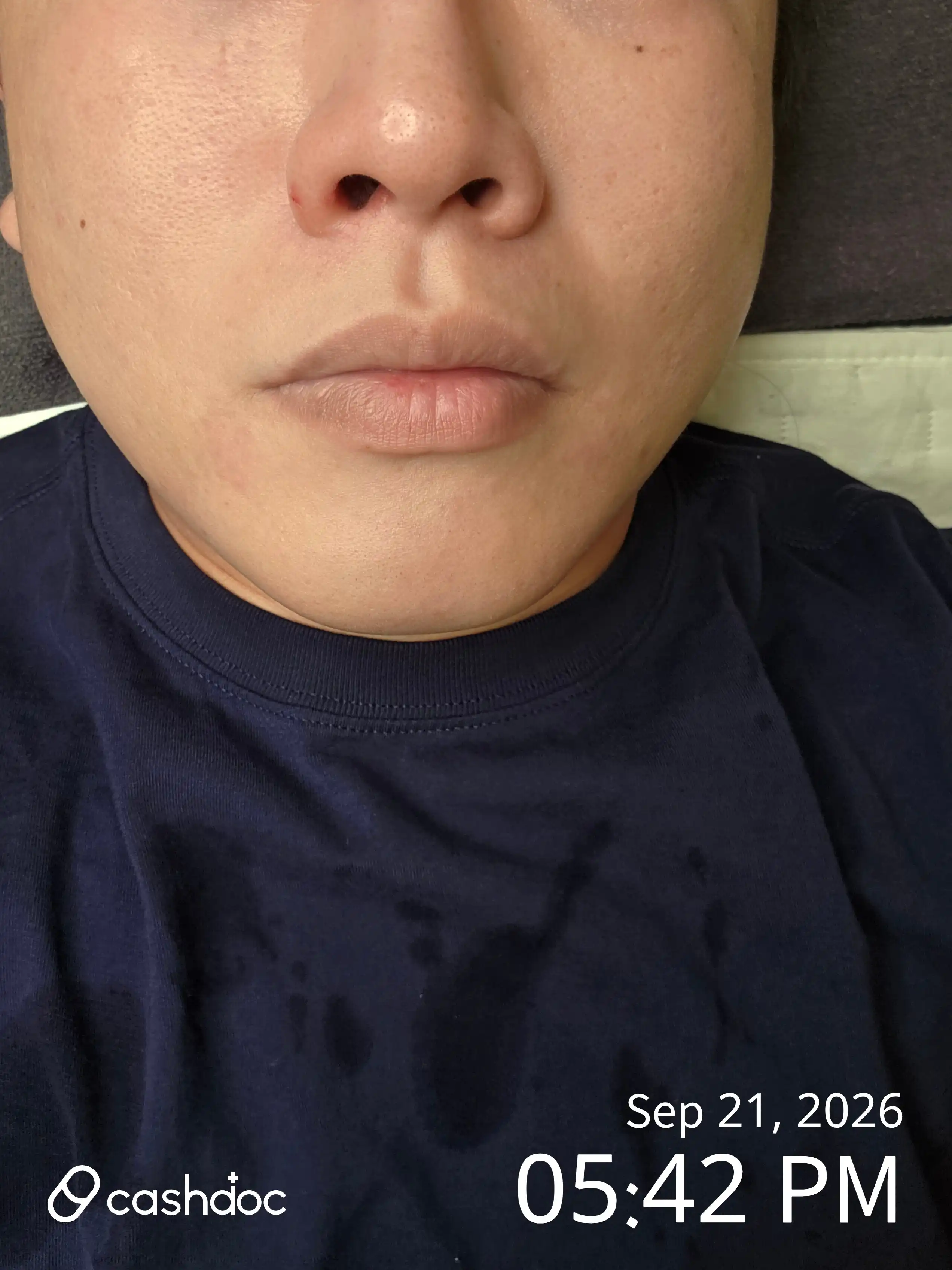 评价照片
