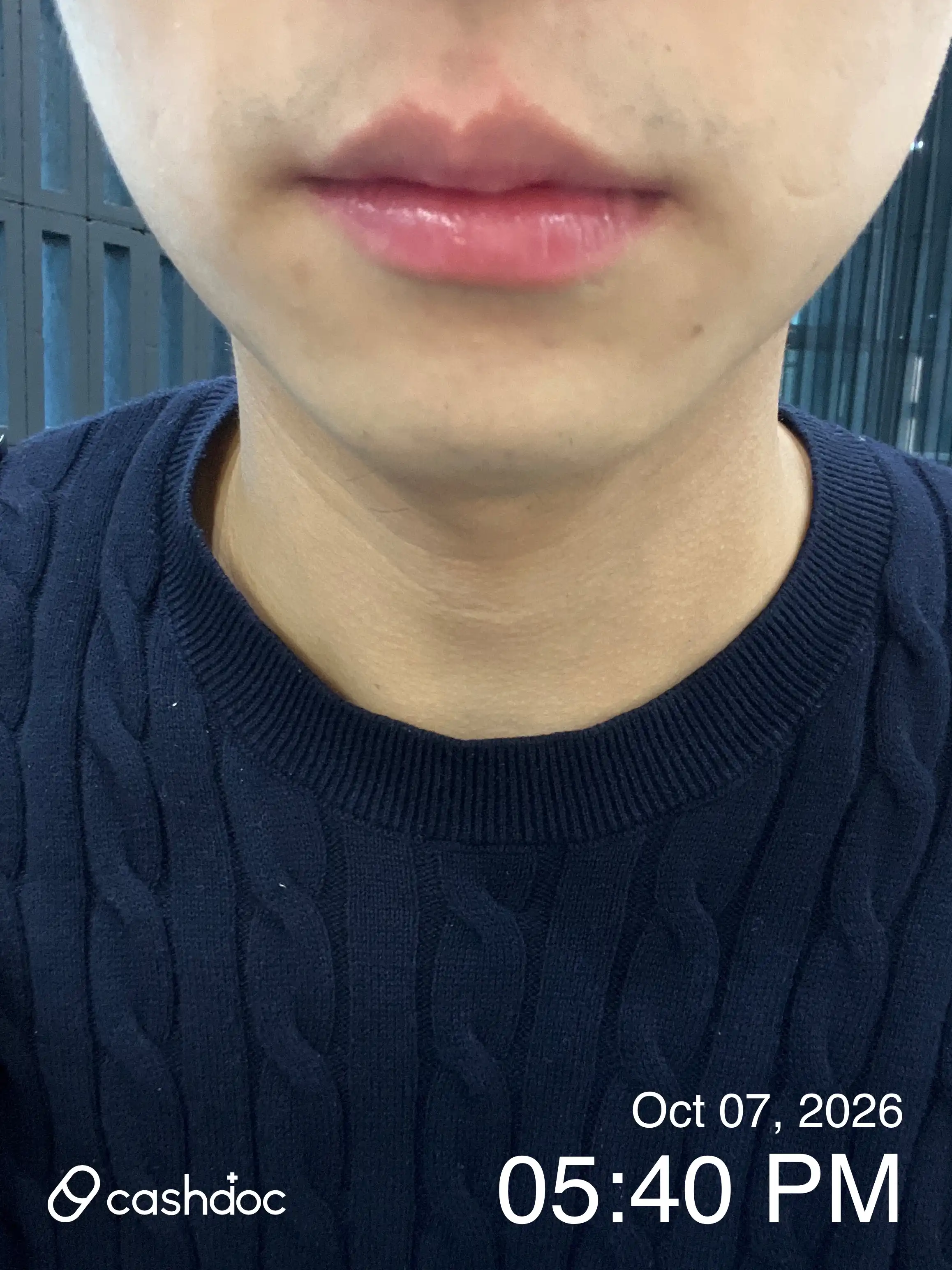 리뷰 사진