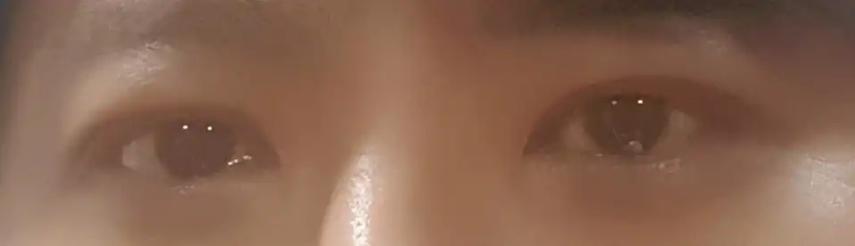 후