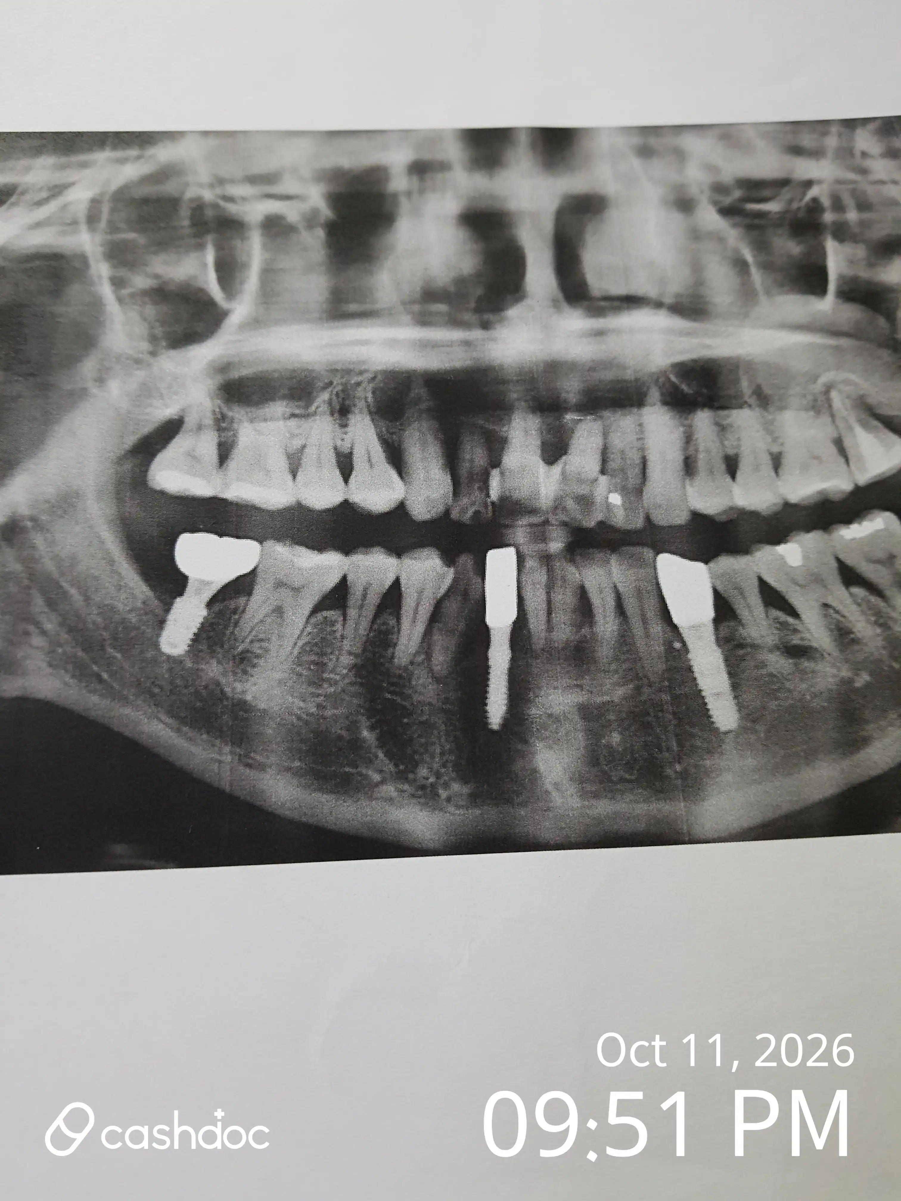 Review photo
