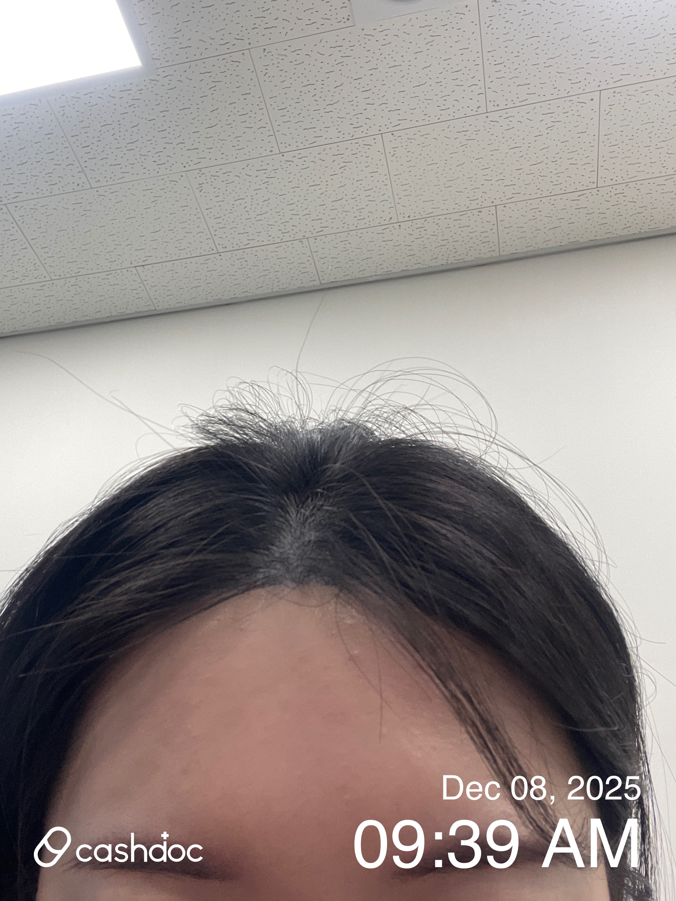 부천 바로그의원에서의 보톡스 경험: 짧은 대기시간과 넉넉한 주차, 다만 의사 선택에 따라 만족도 차이 있어요