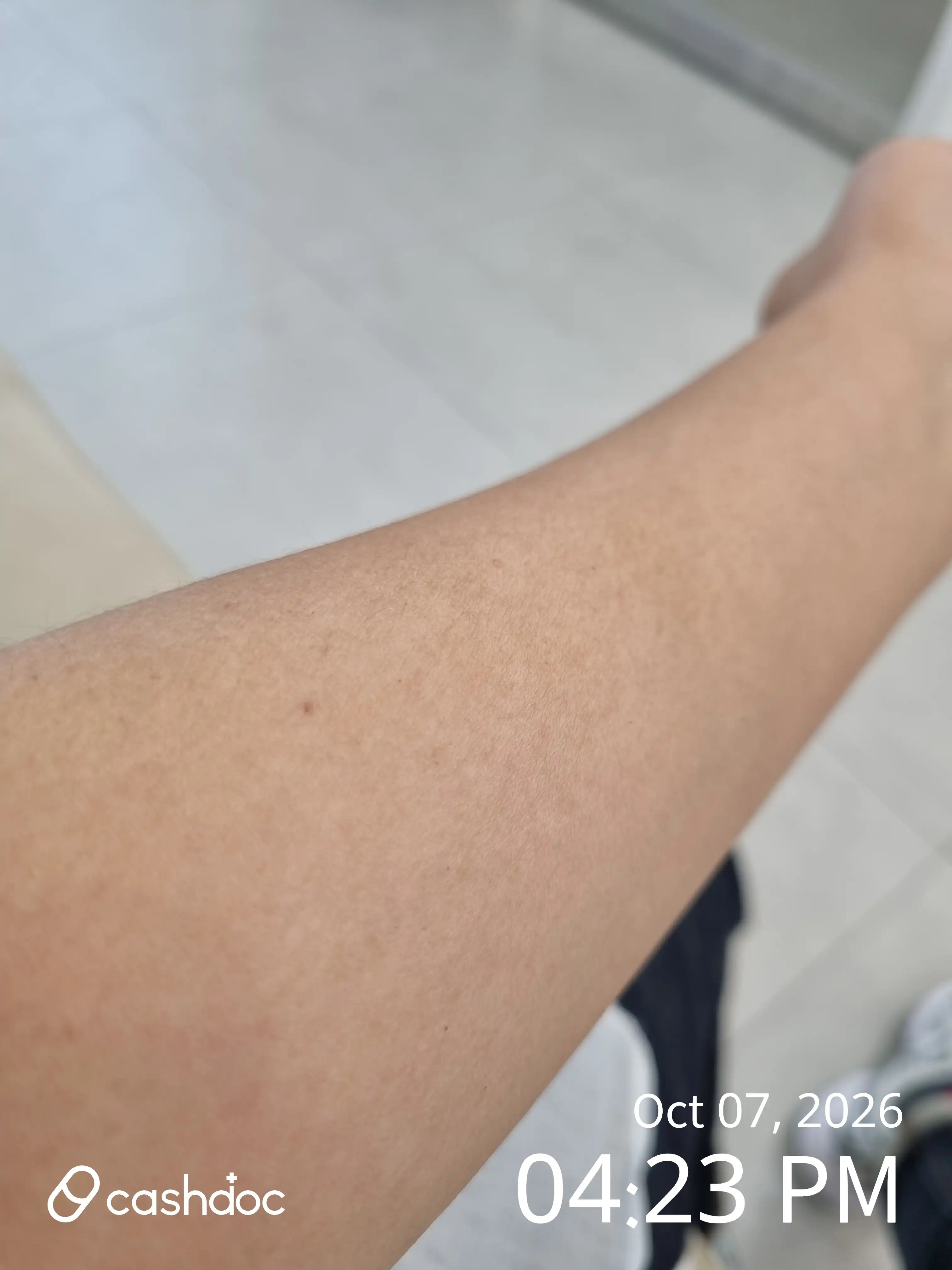 상모삼성연합의원 후기 사진